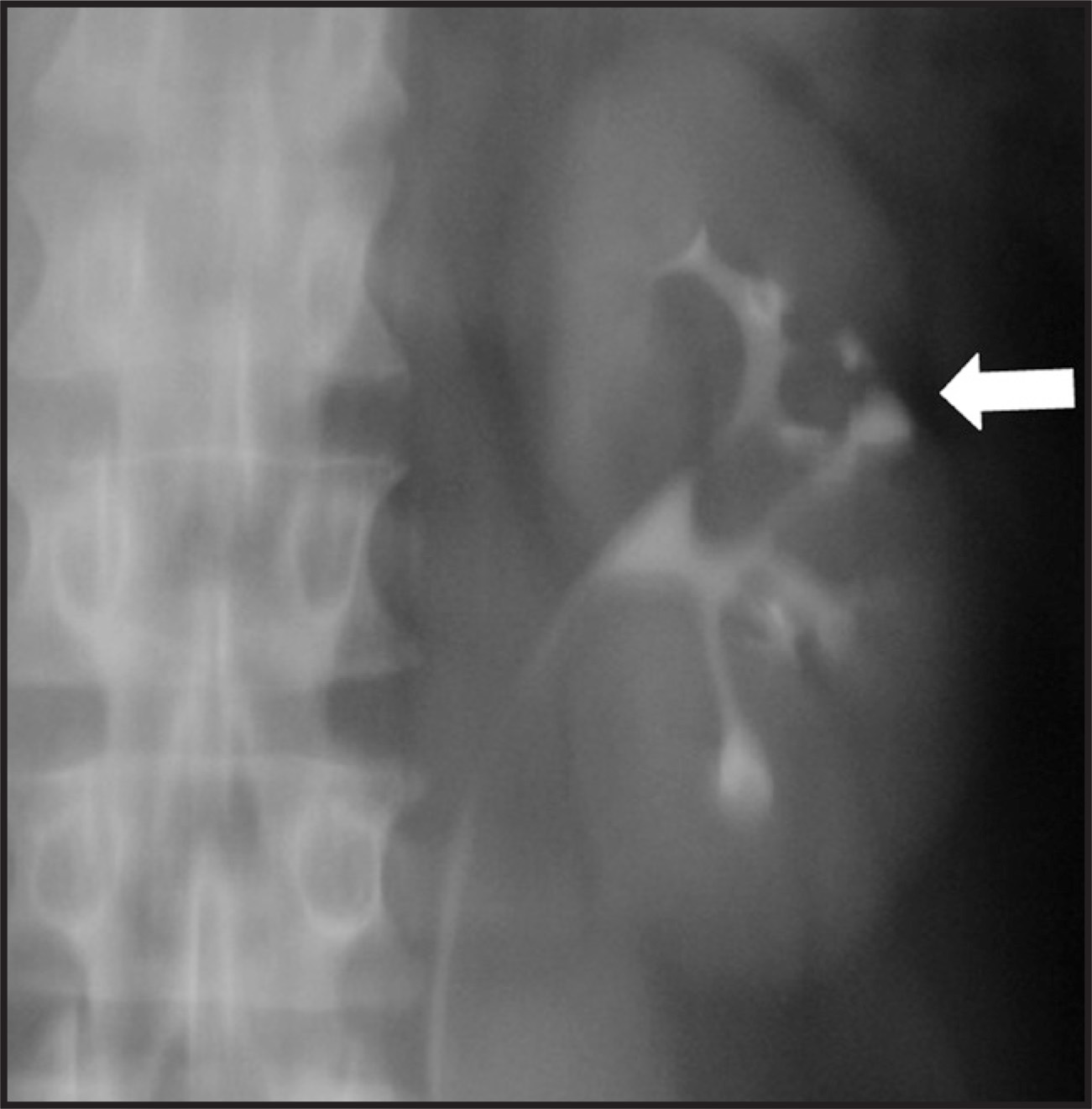 FIGURE 11.