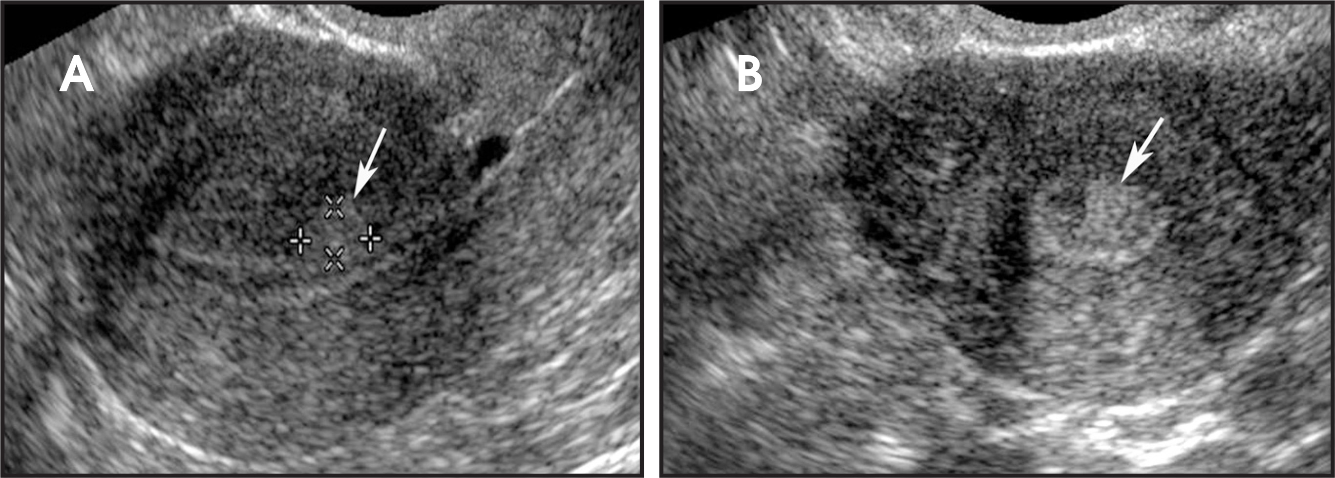 FIGURE 4.