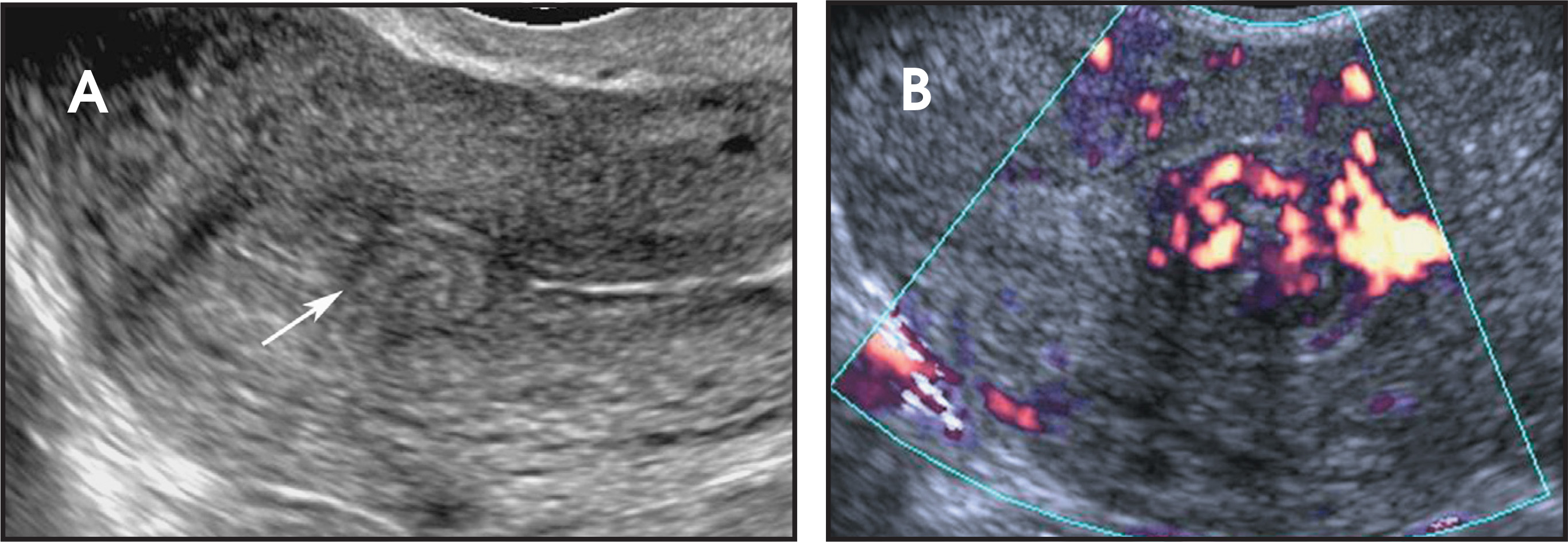 FIGURE 10.
