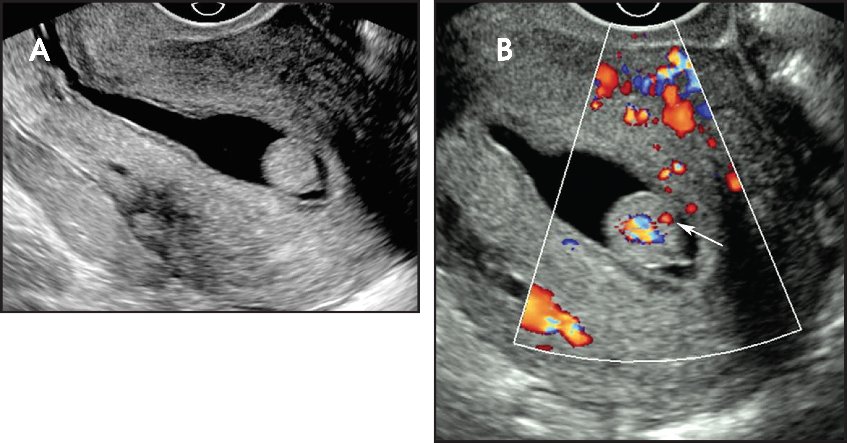 FIGURE 11.