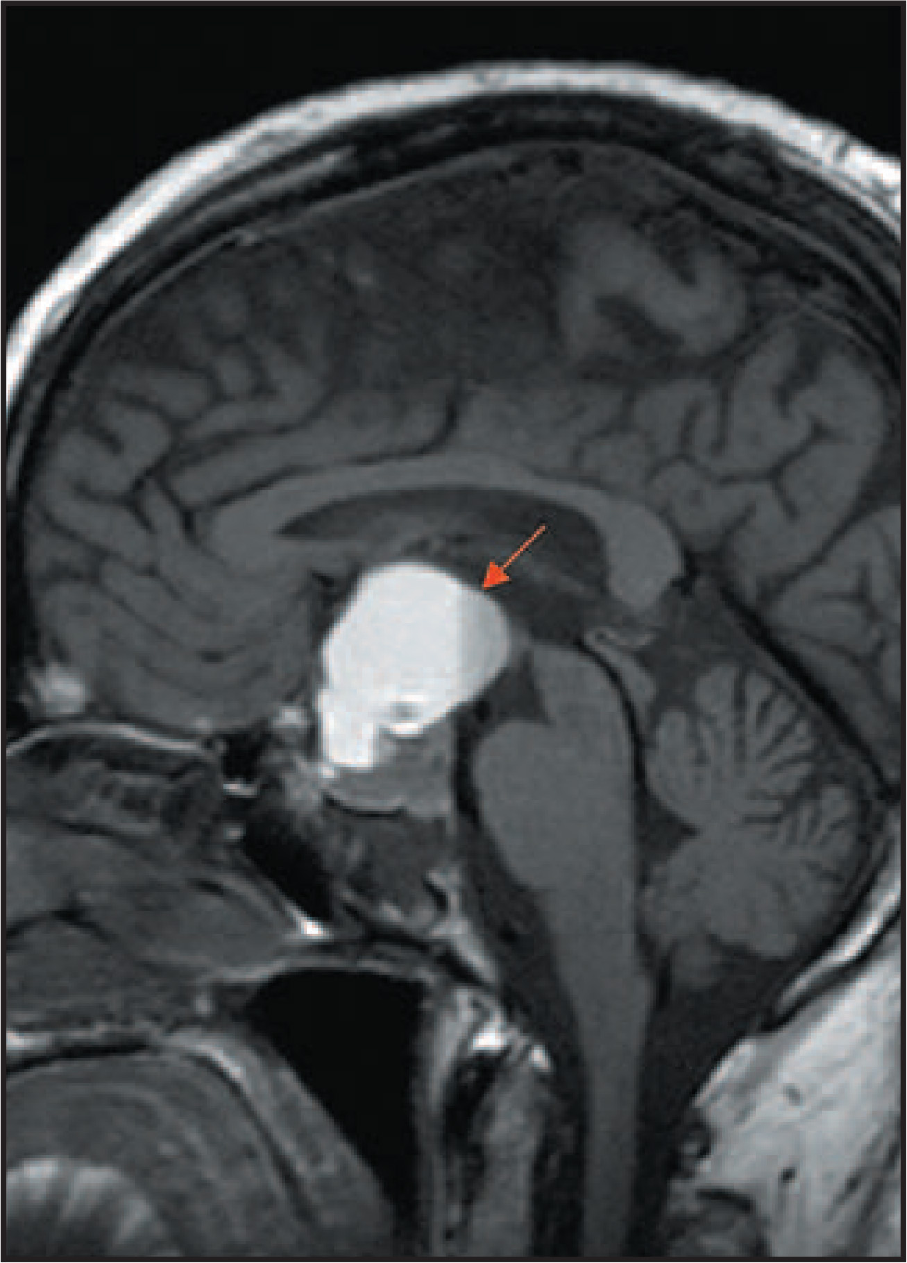 FIGURE 7.