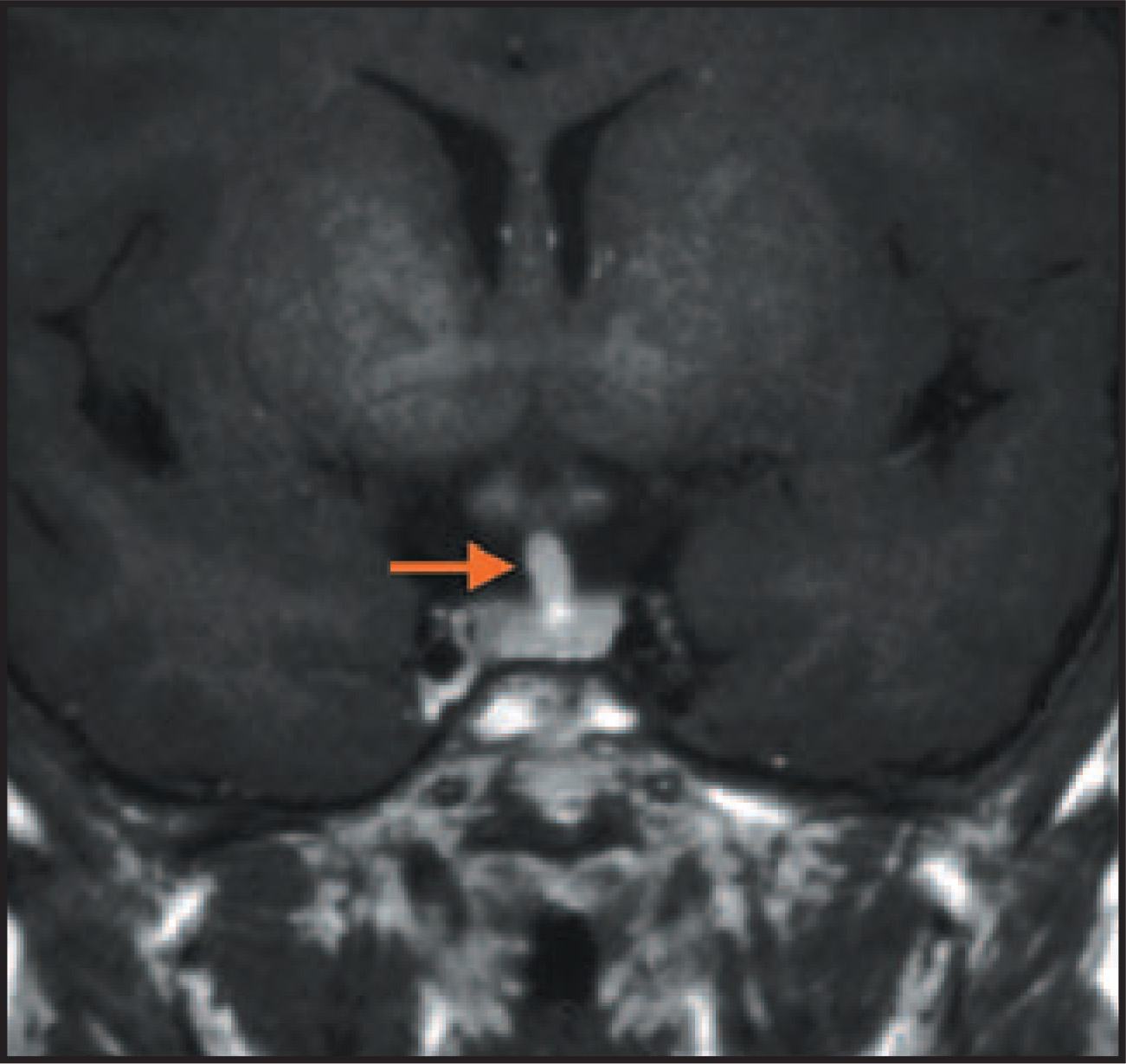 FIGURE 10.
