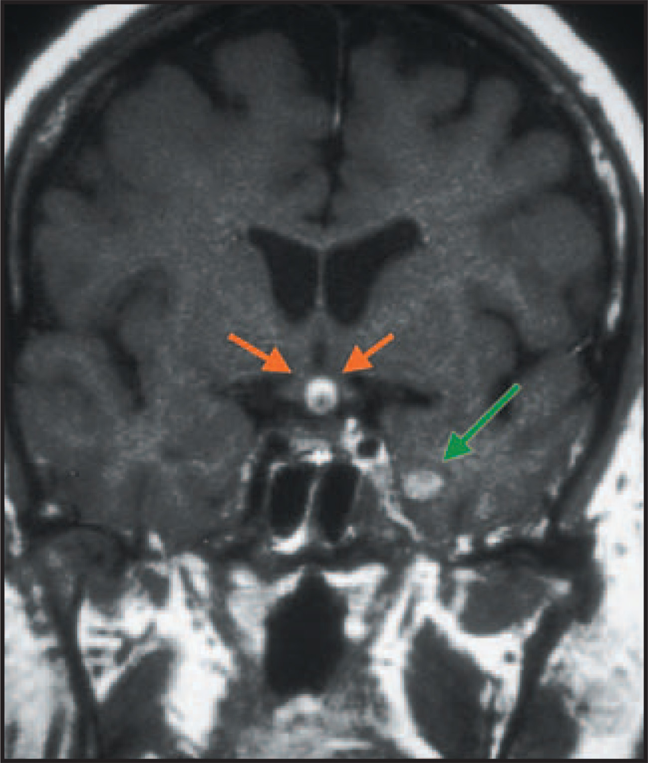 FIGURE 12.