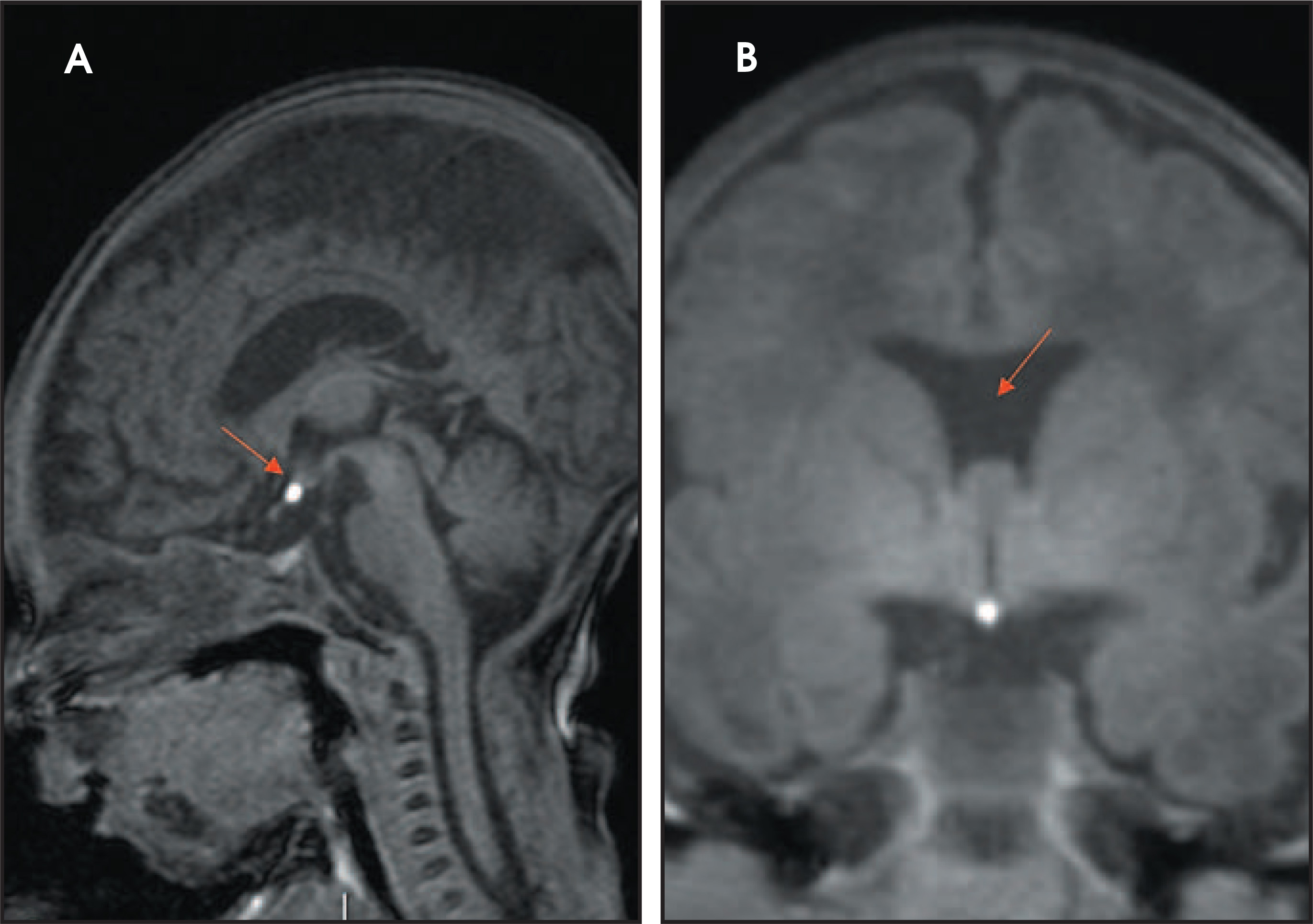 FIGURE 14.