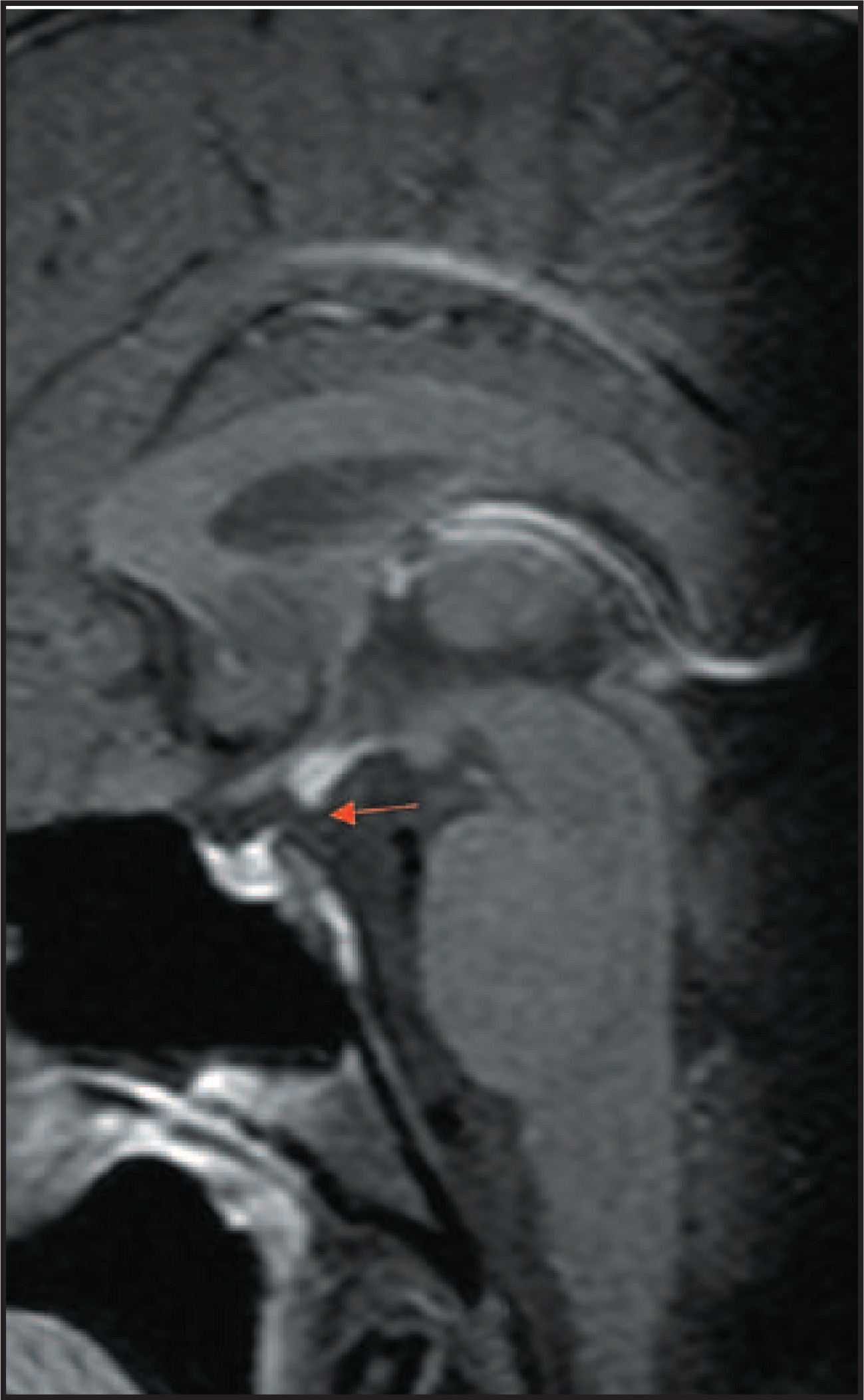 FIGURE 15.