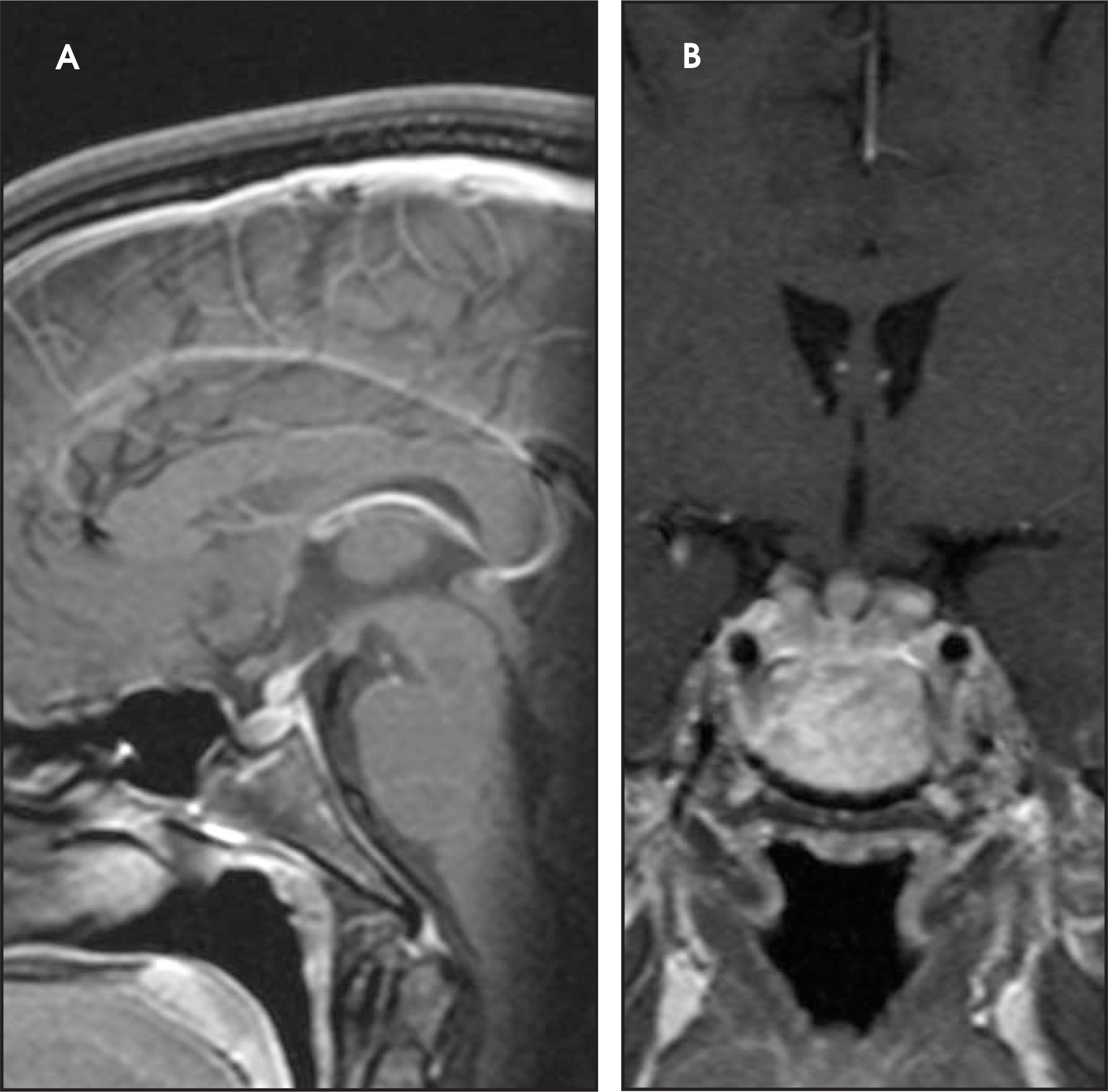 FIGURE 16.