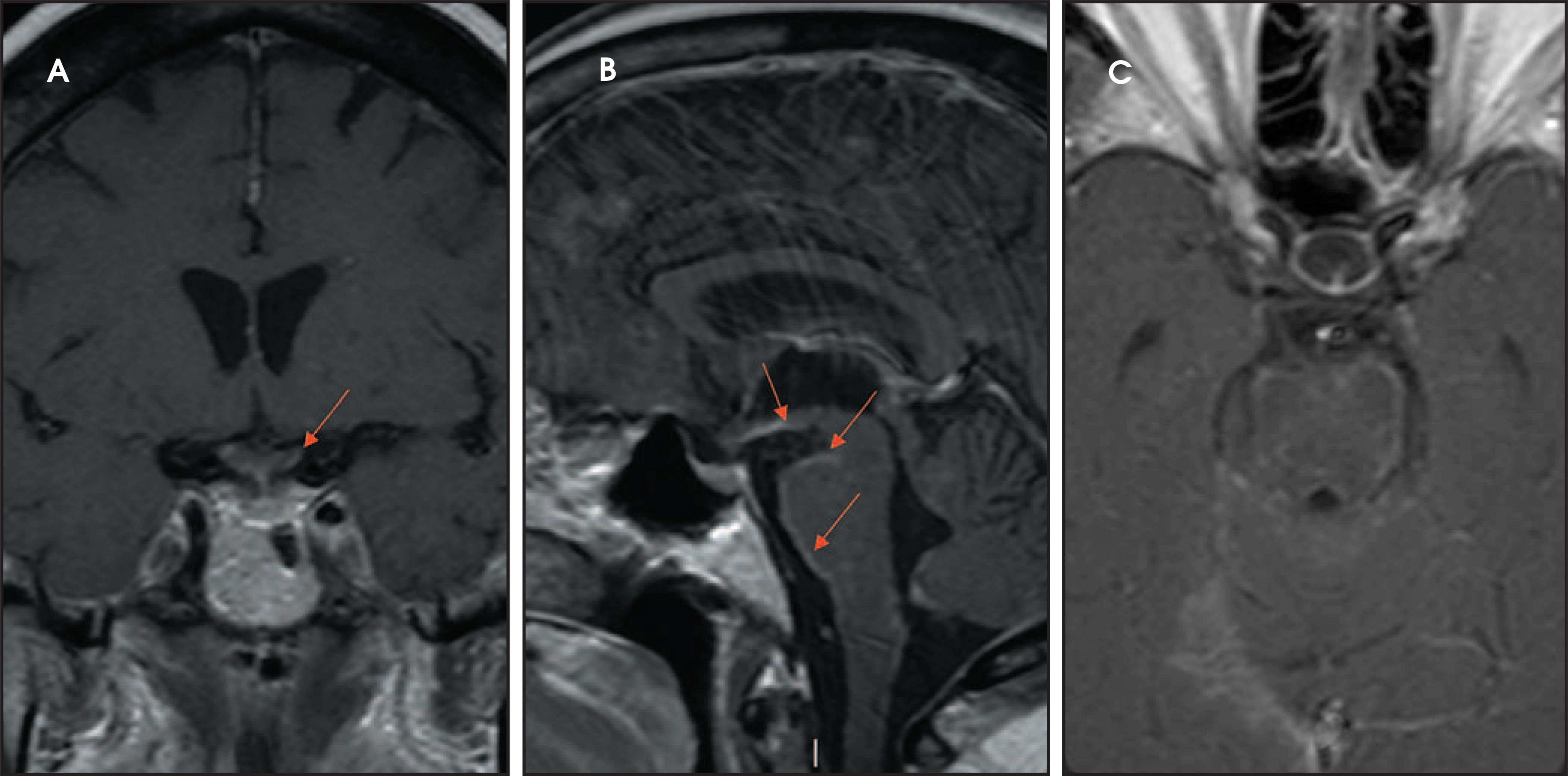 FIGURE 17.