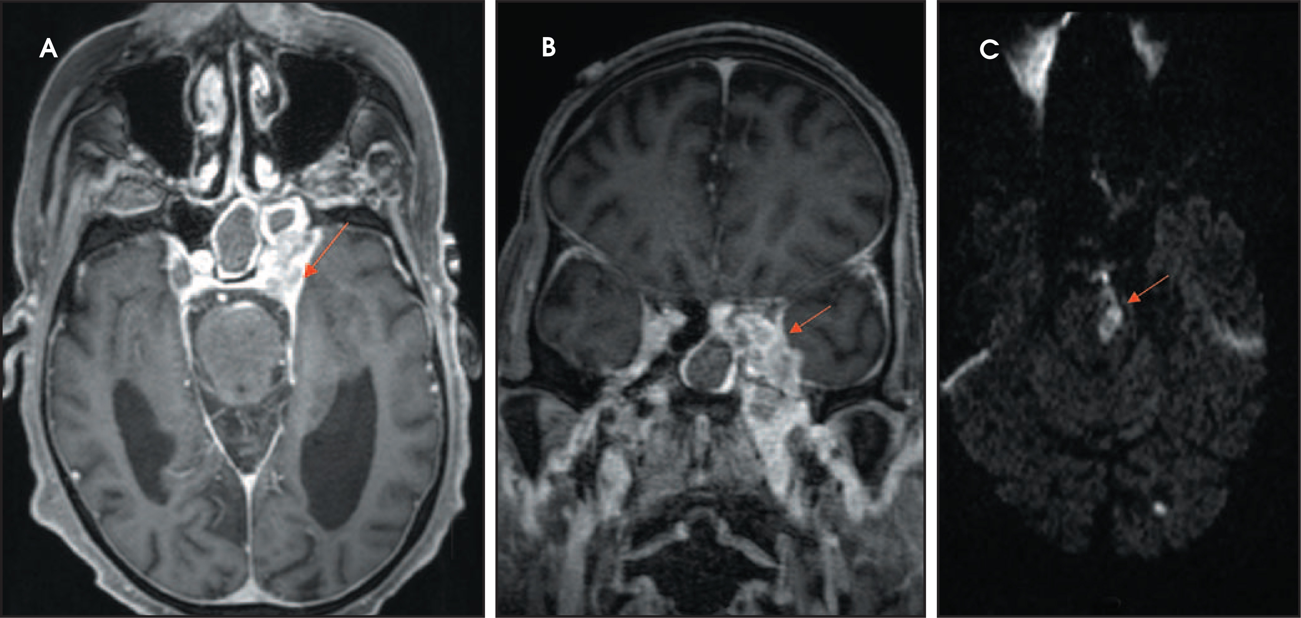 FIGURE 18.