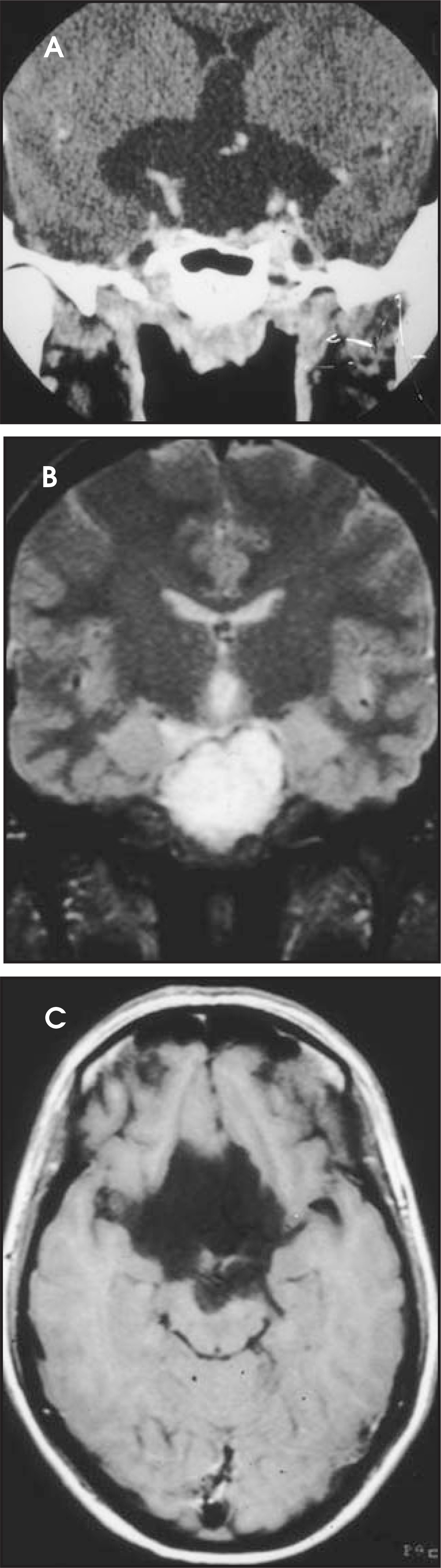 FIGURE 22.