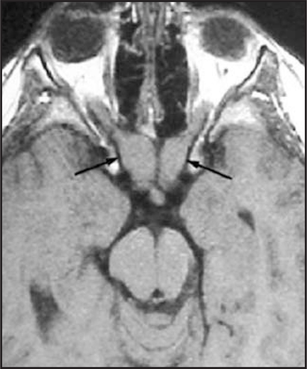 FIGURE 23.
