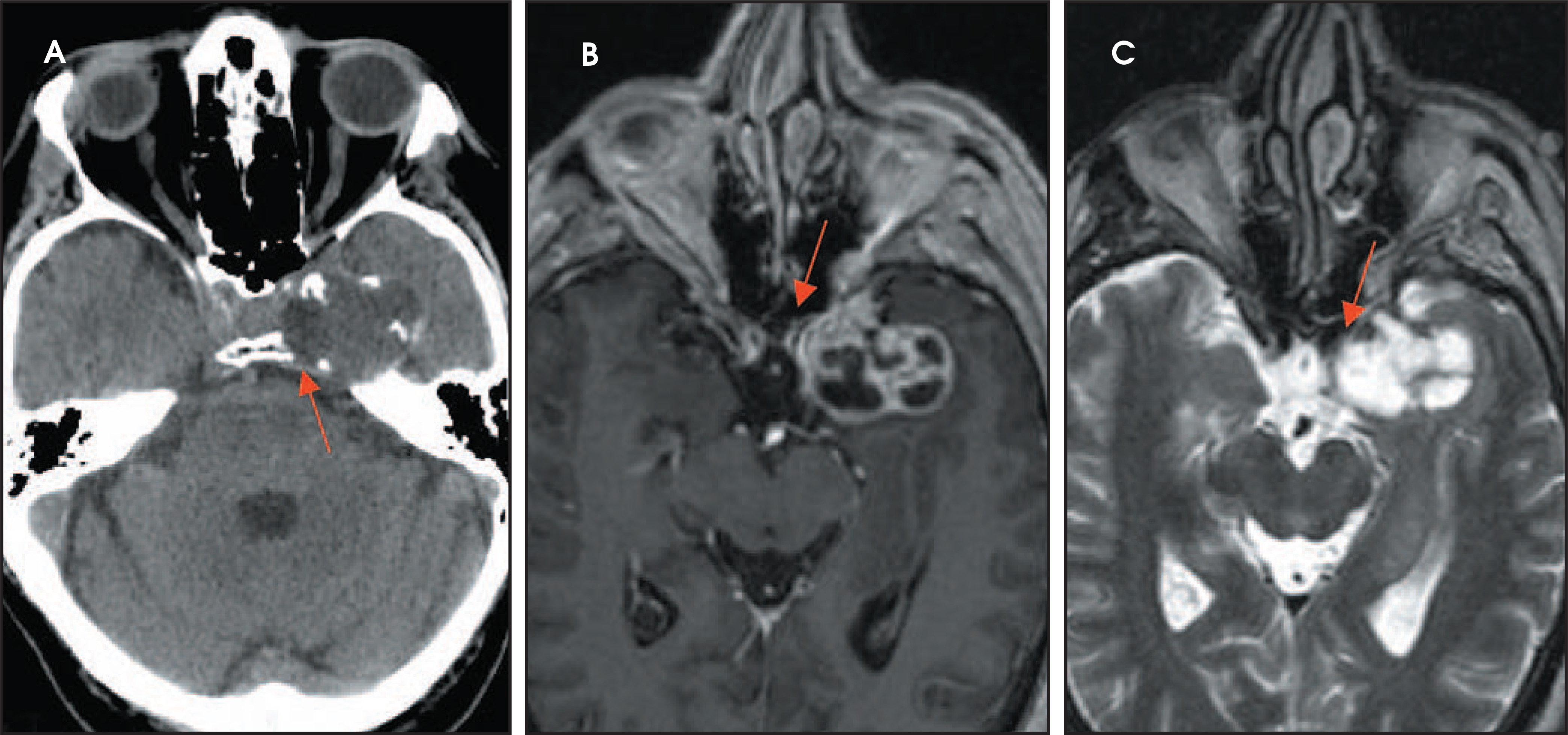 FIGURE 25.
