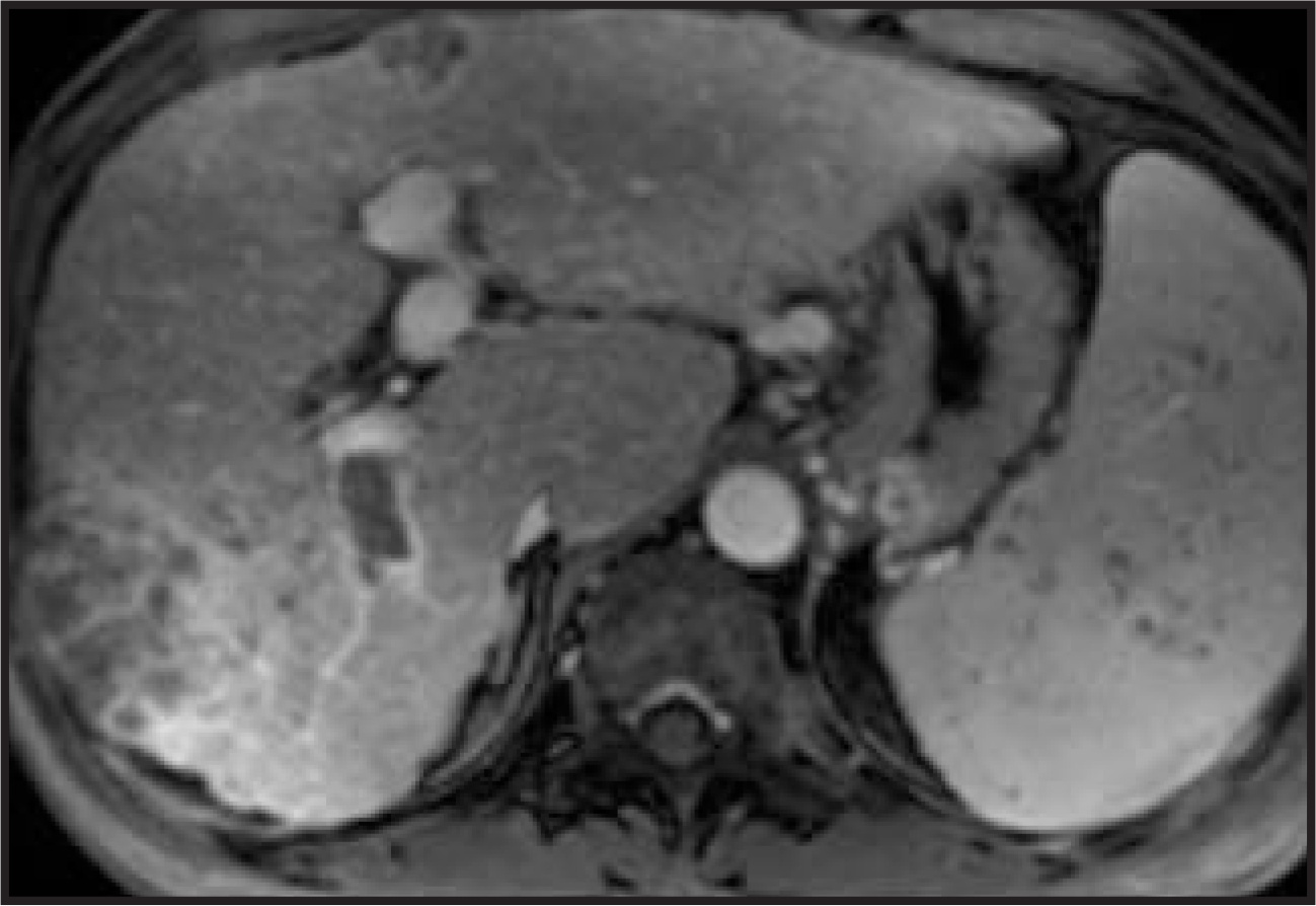FIGURE 11.