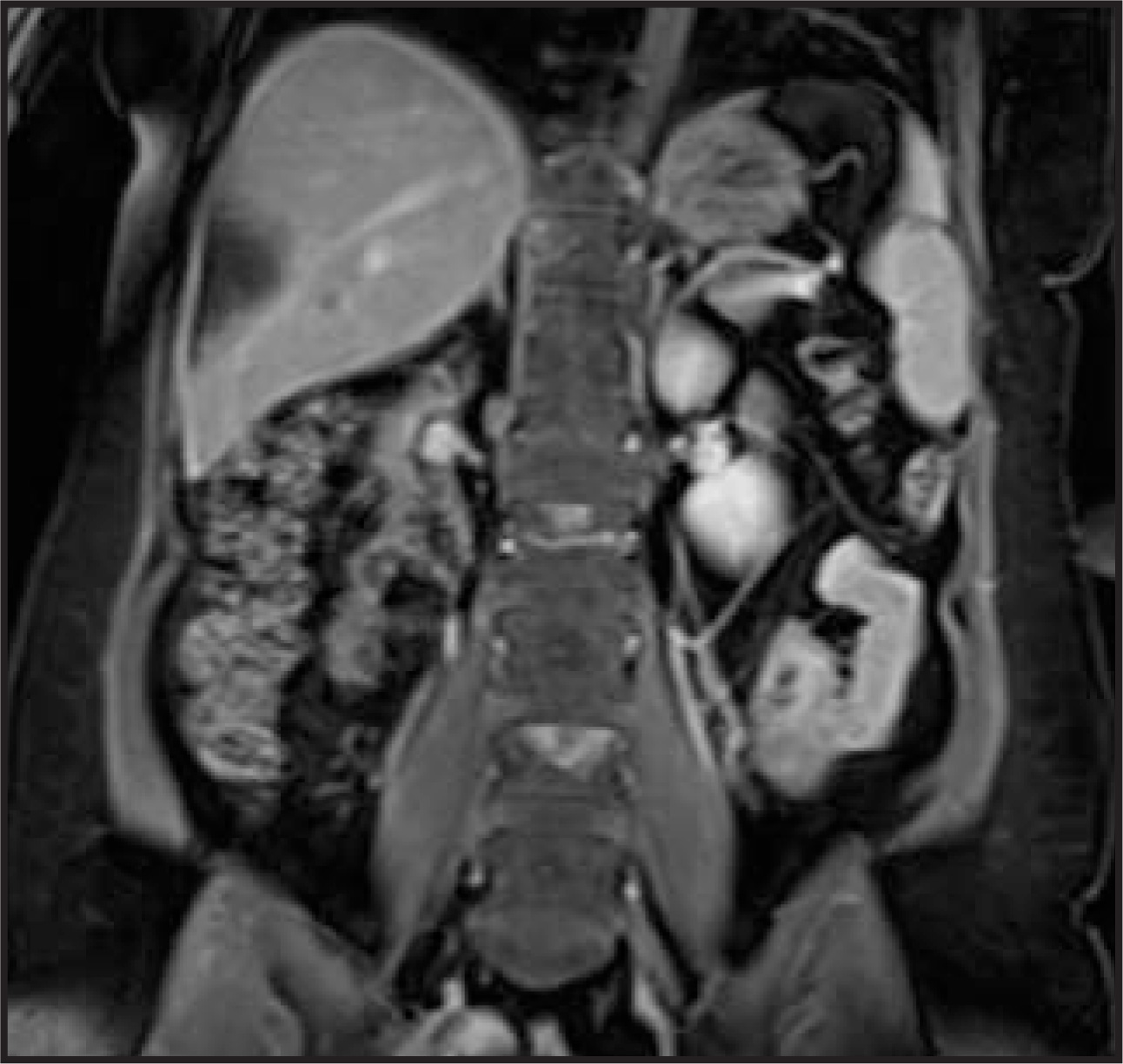 FIGURE 13.