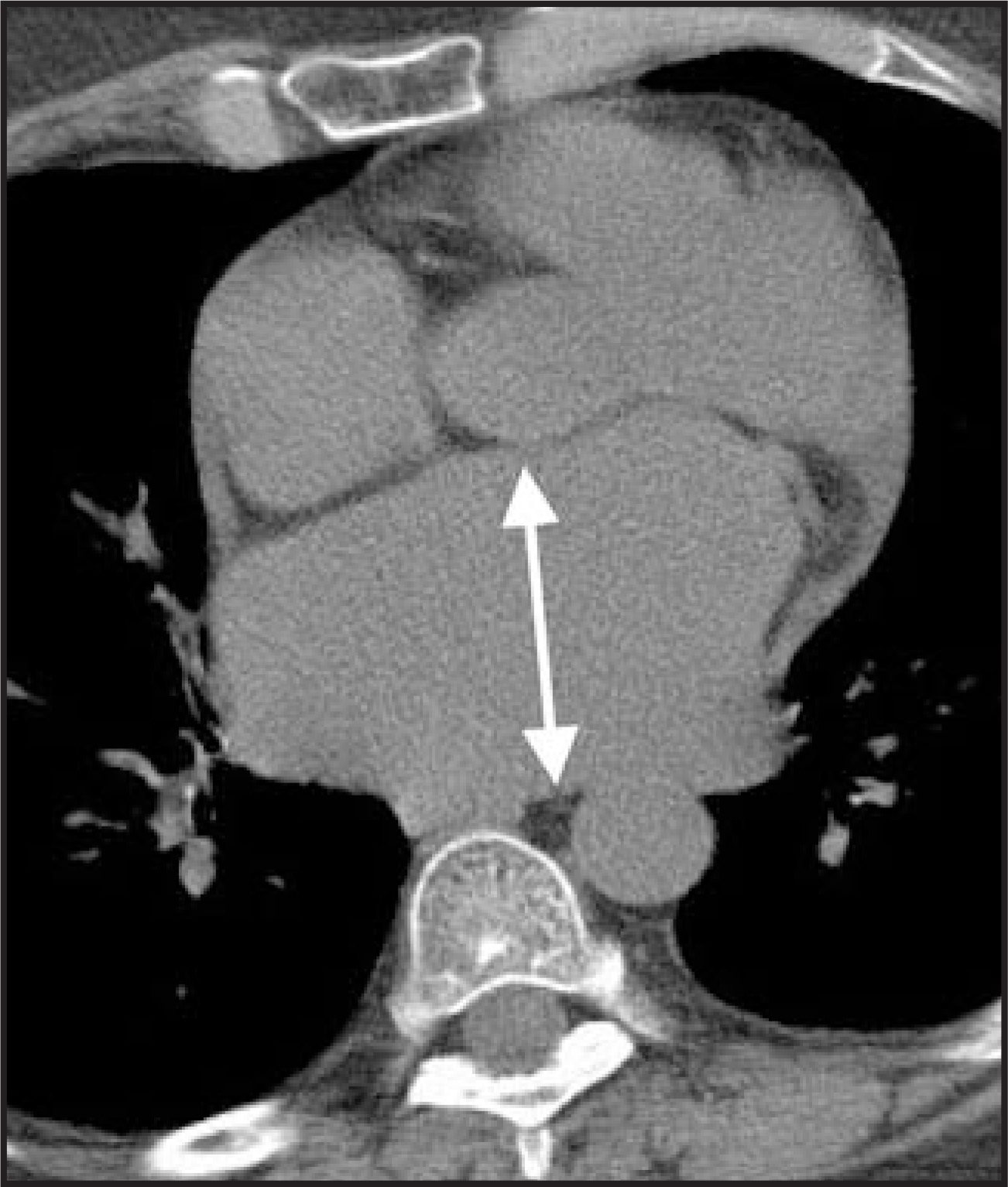 FIGURE 11.