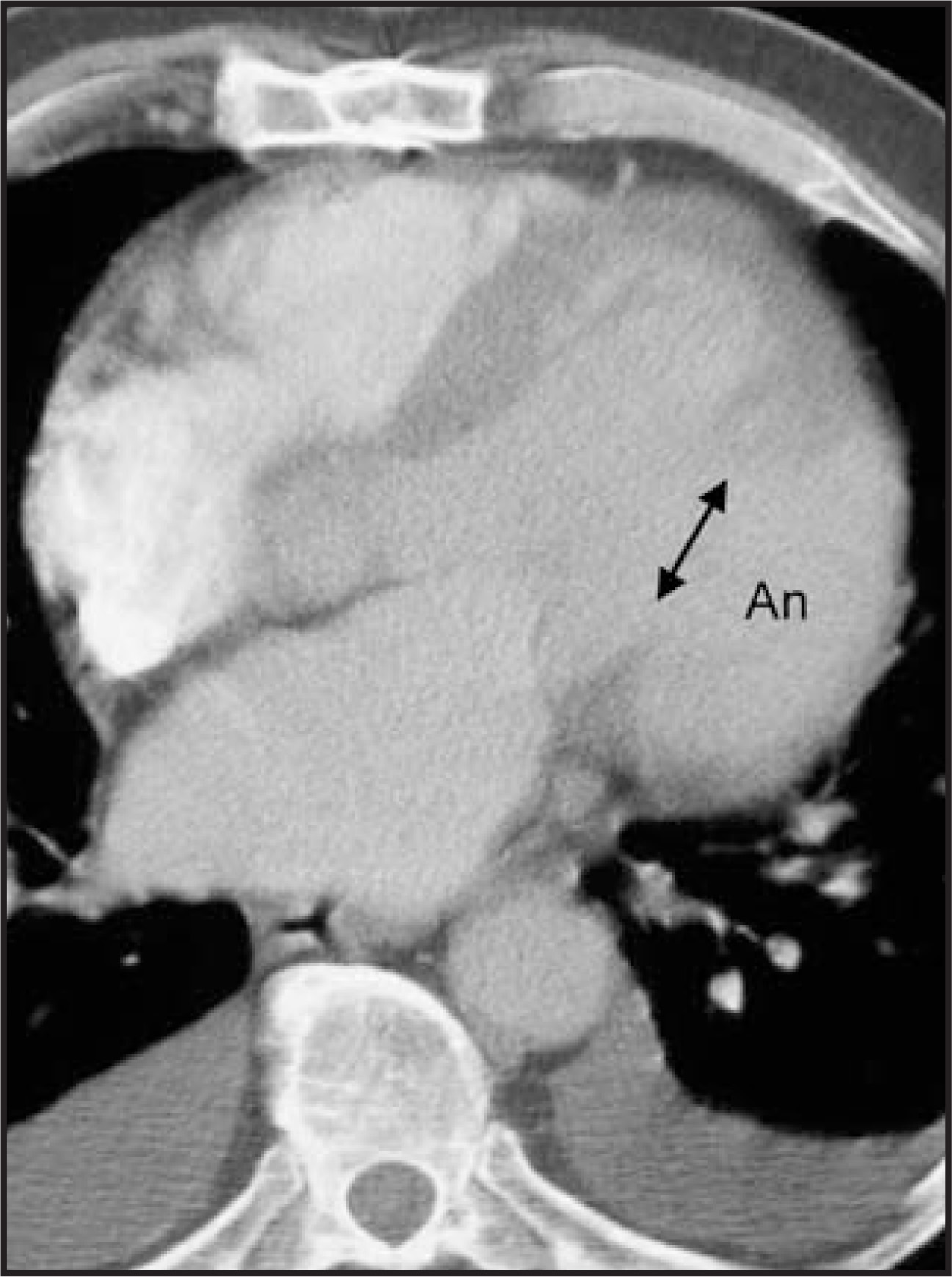 FIGURE 14.