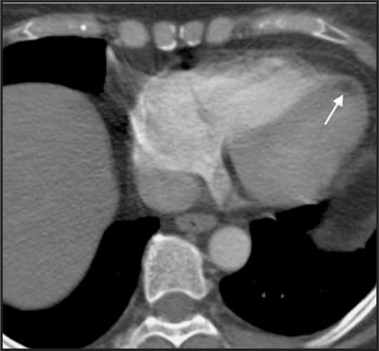 FIGURE 15.