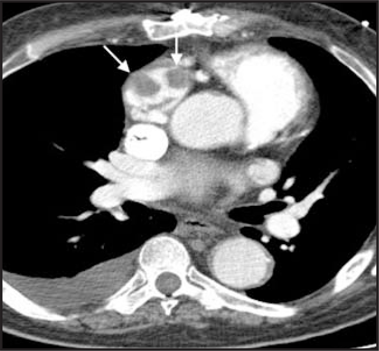 FIGURE 16.