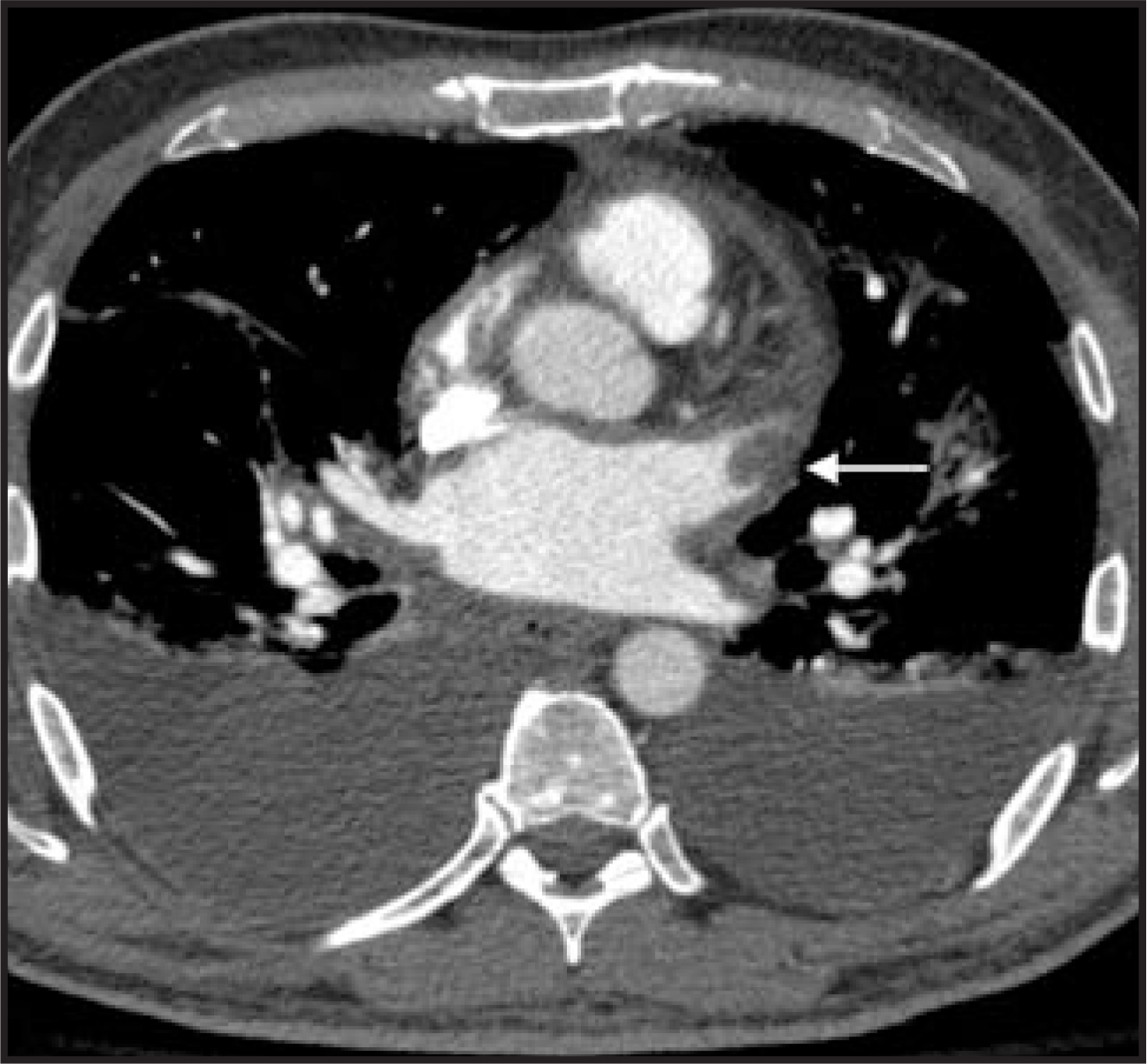 FIGURE 17.