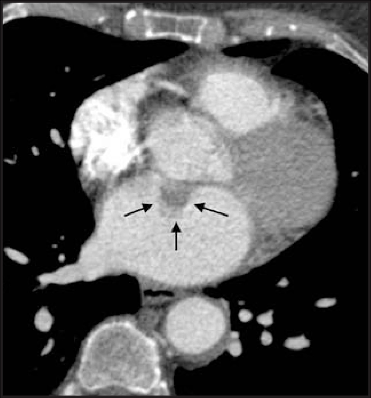 FIGURE 18.