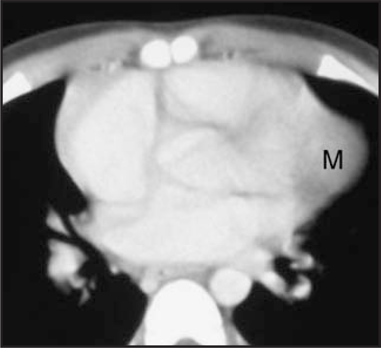 FIGURE 20.