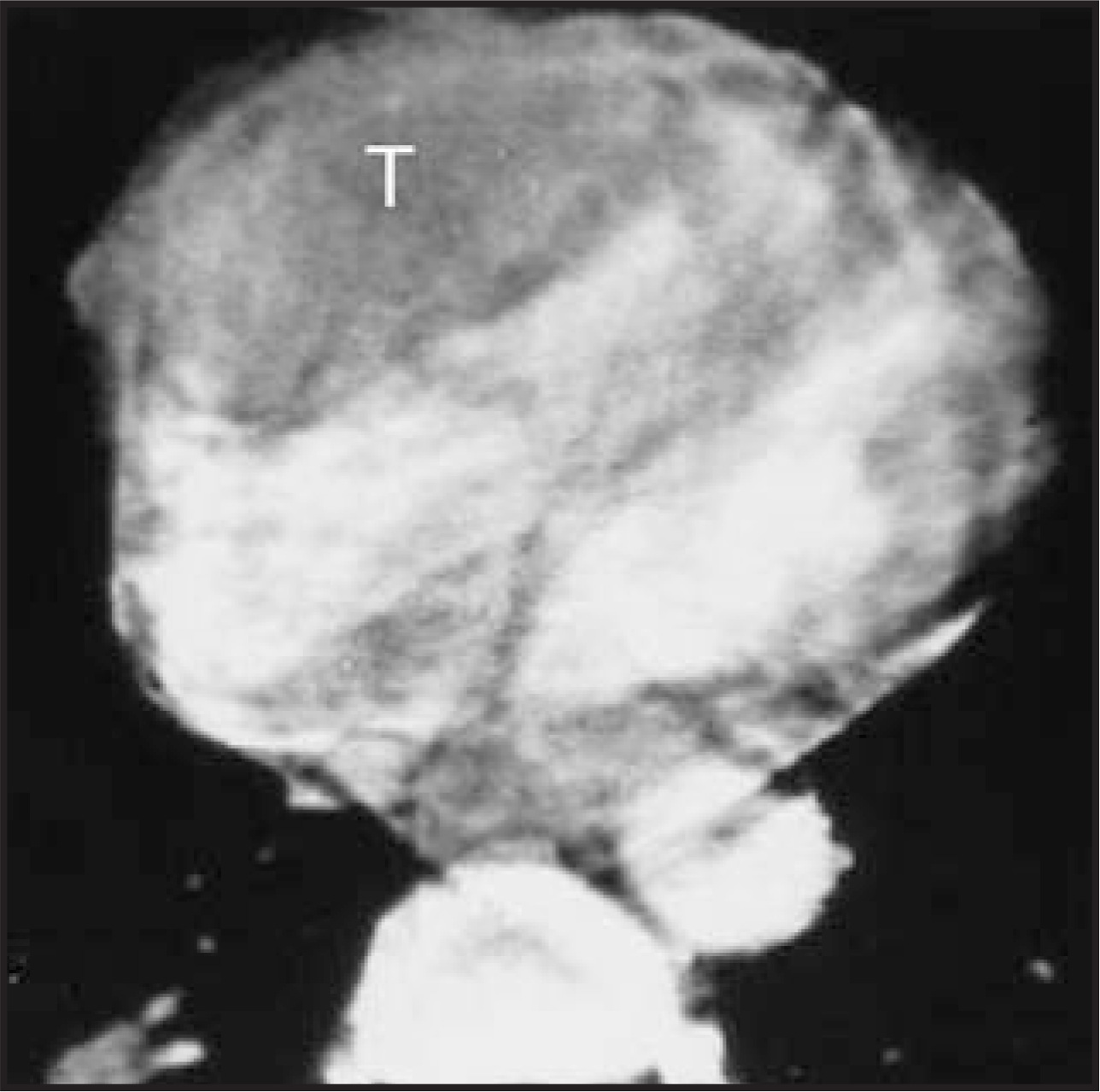 FIGURE 21.