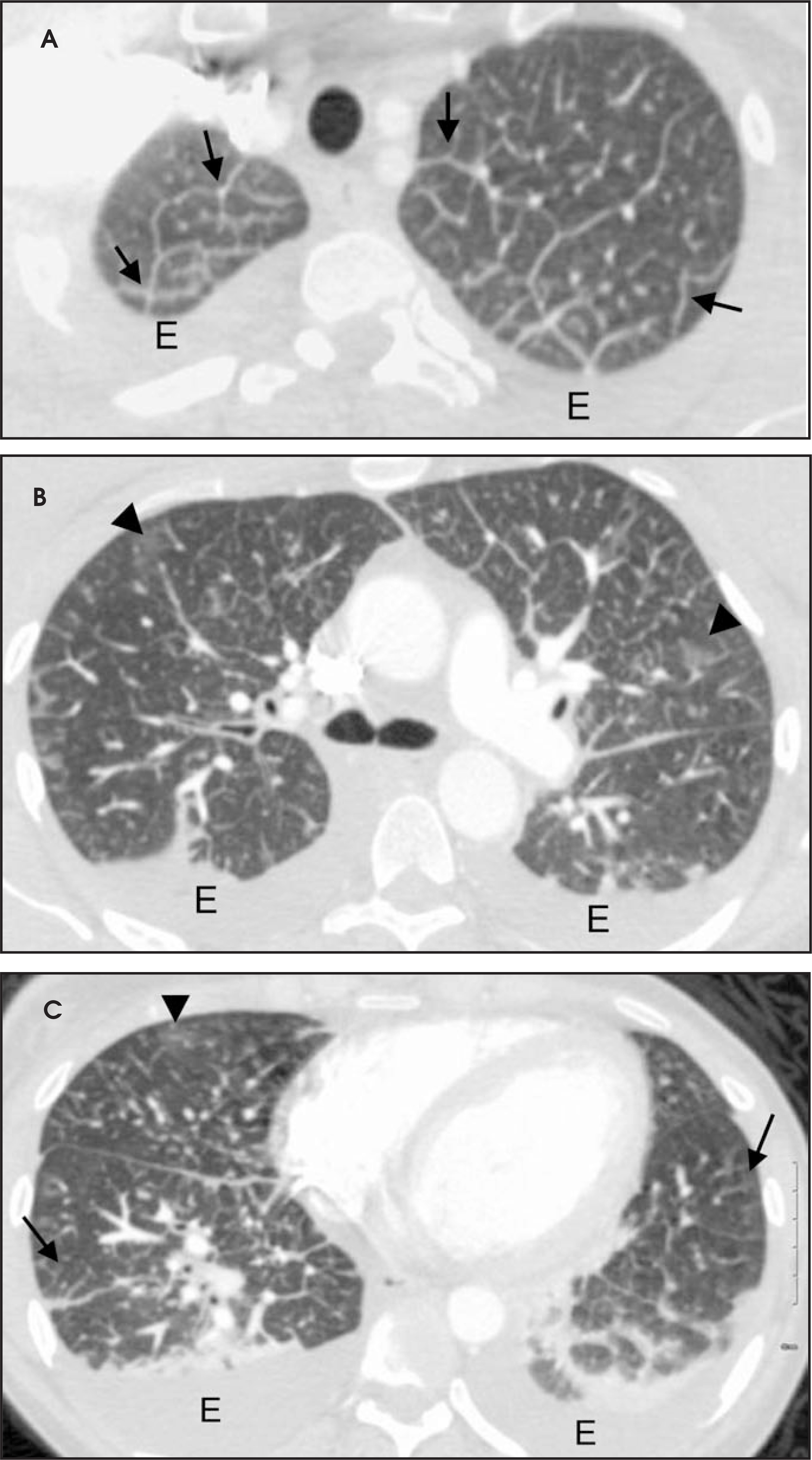 FIGURE 22.