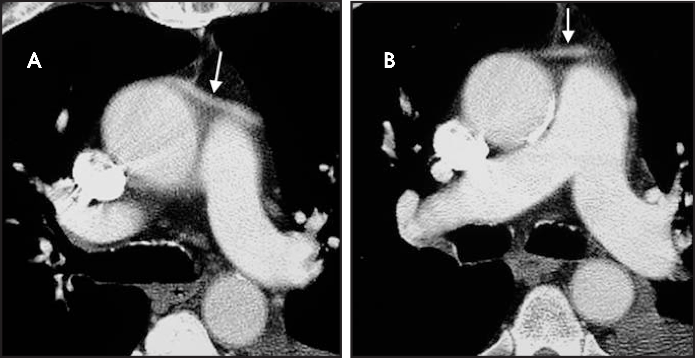 FIGURE 25.