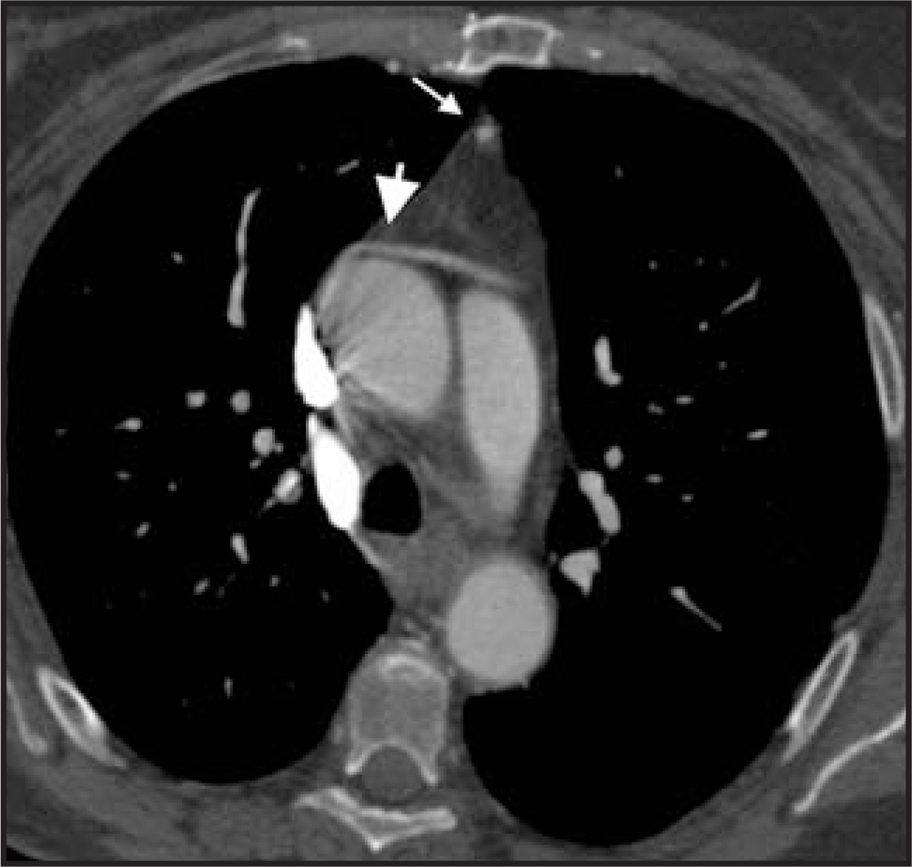 FIGURE 26.