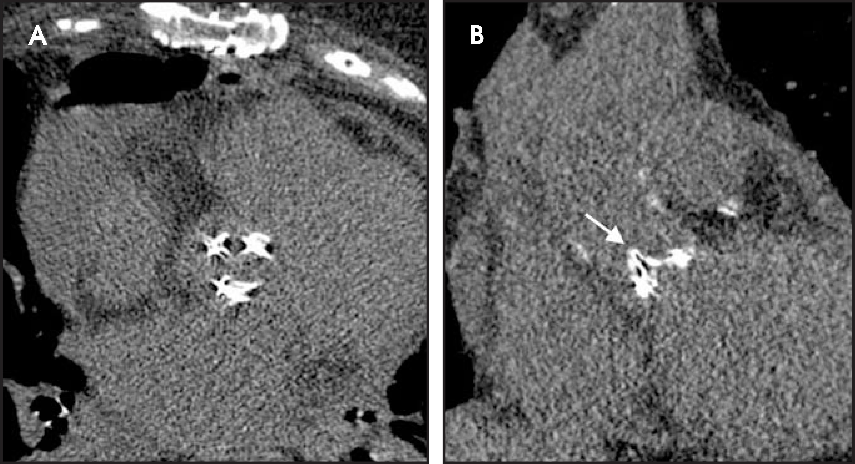 FIGURE 30.
