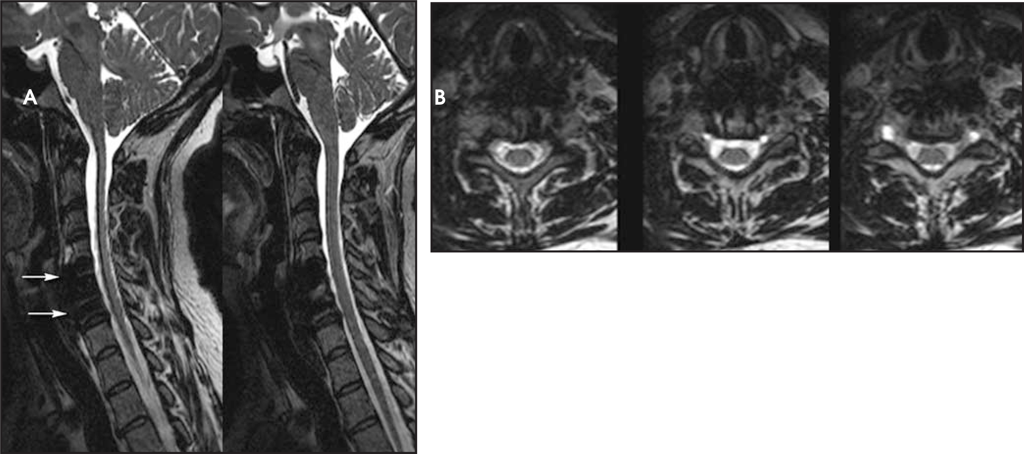 FIGURE 11.