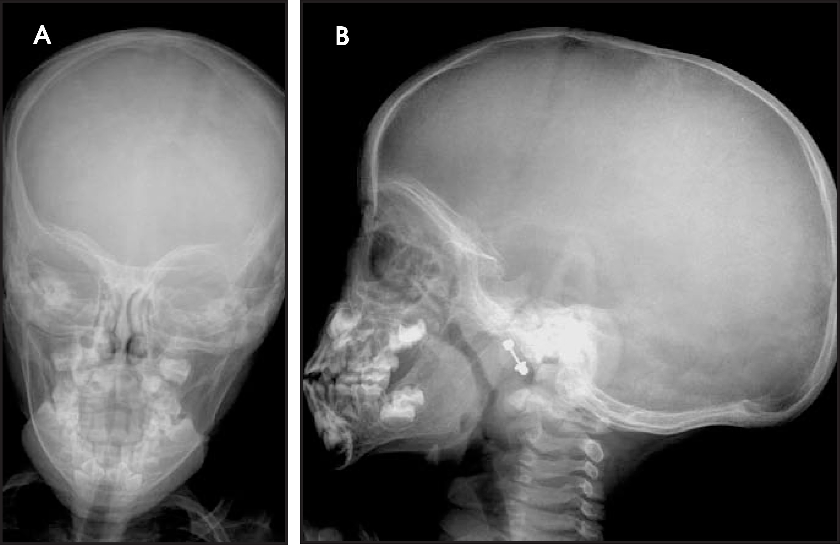 FIGURE 4.