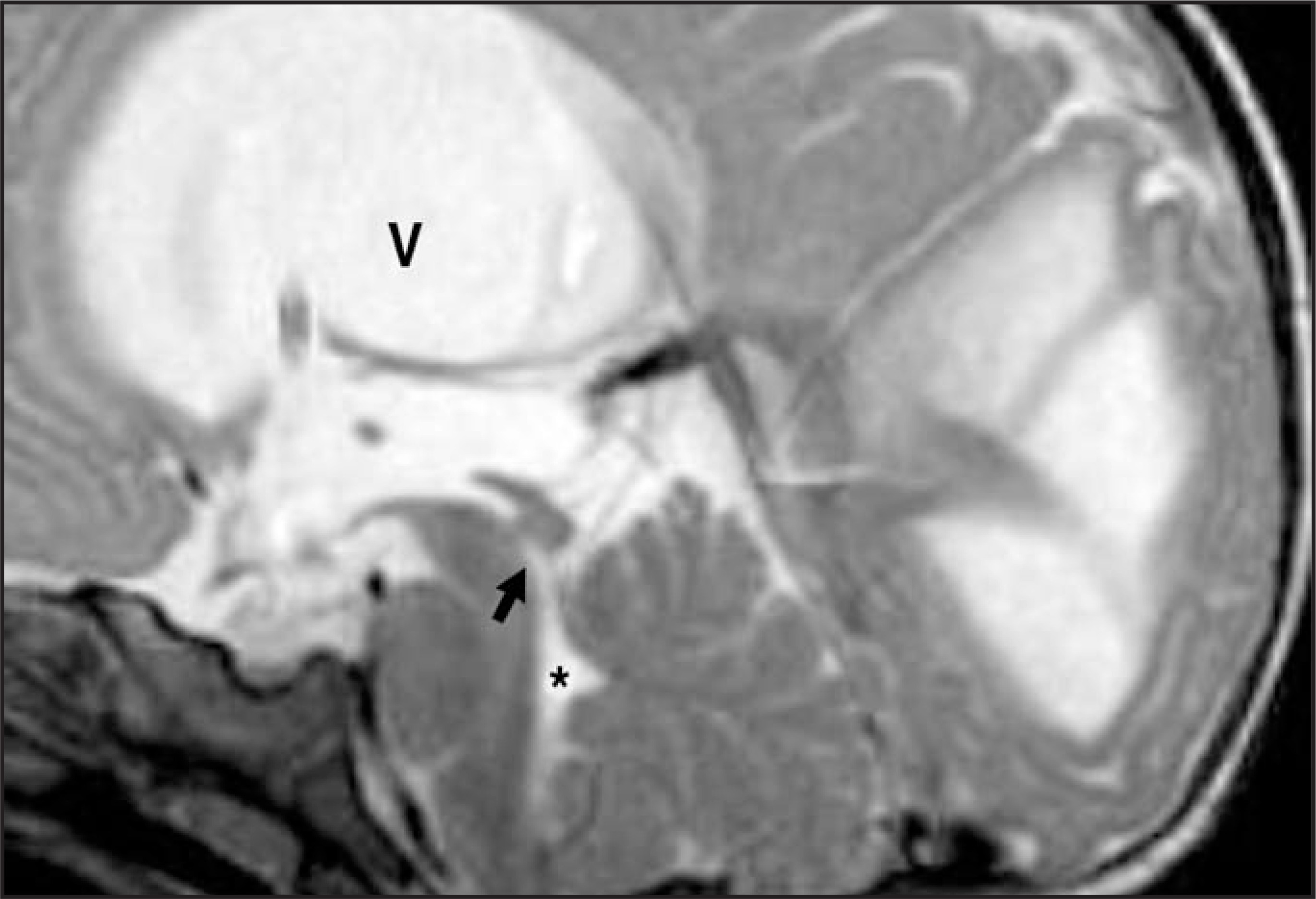 FIGURE 11.