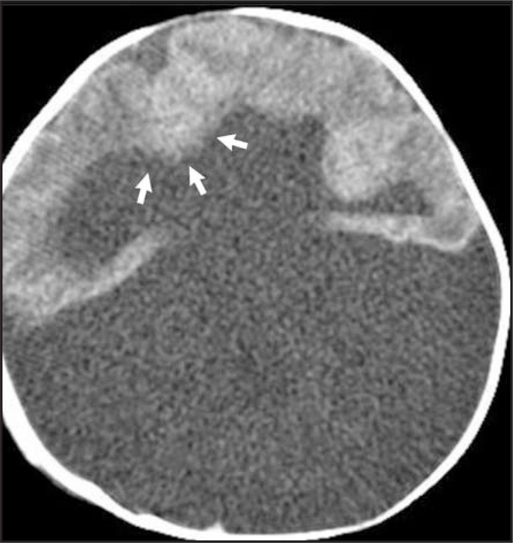 FIGURE 12.