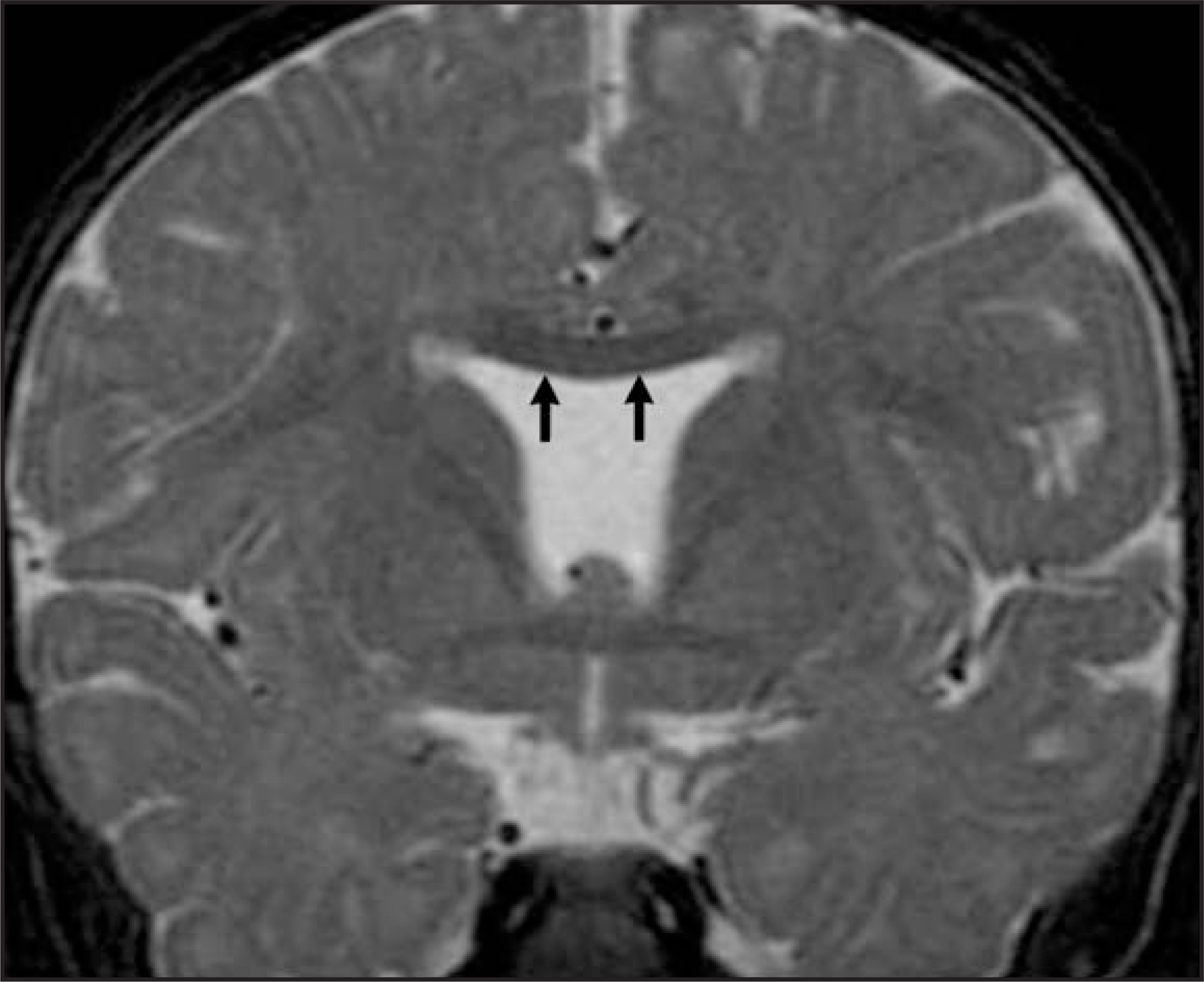 FIGURE 13.