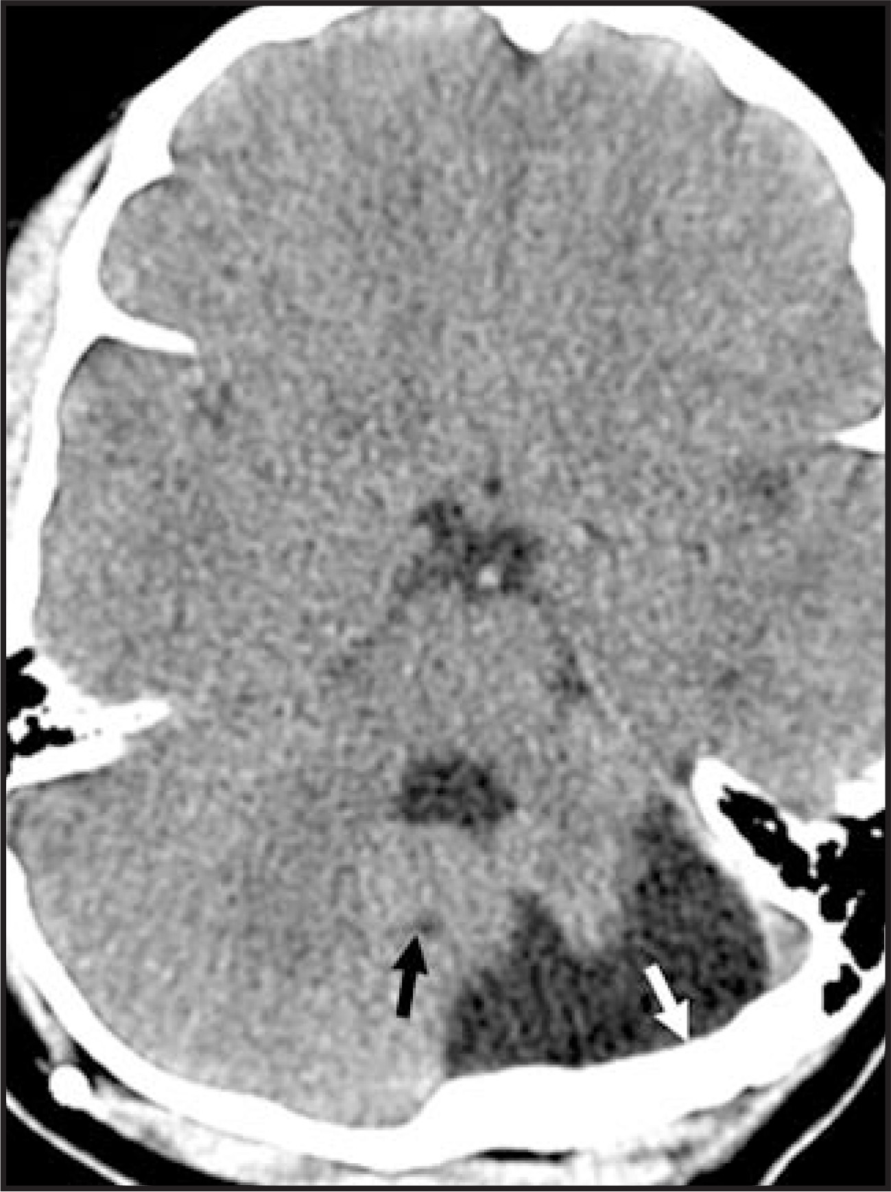 FIGURE 17.