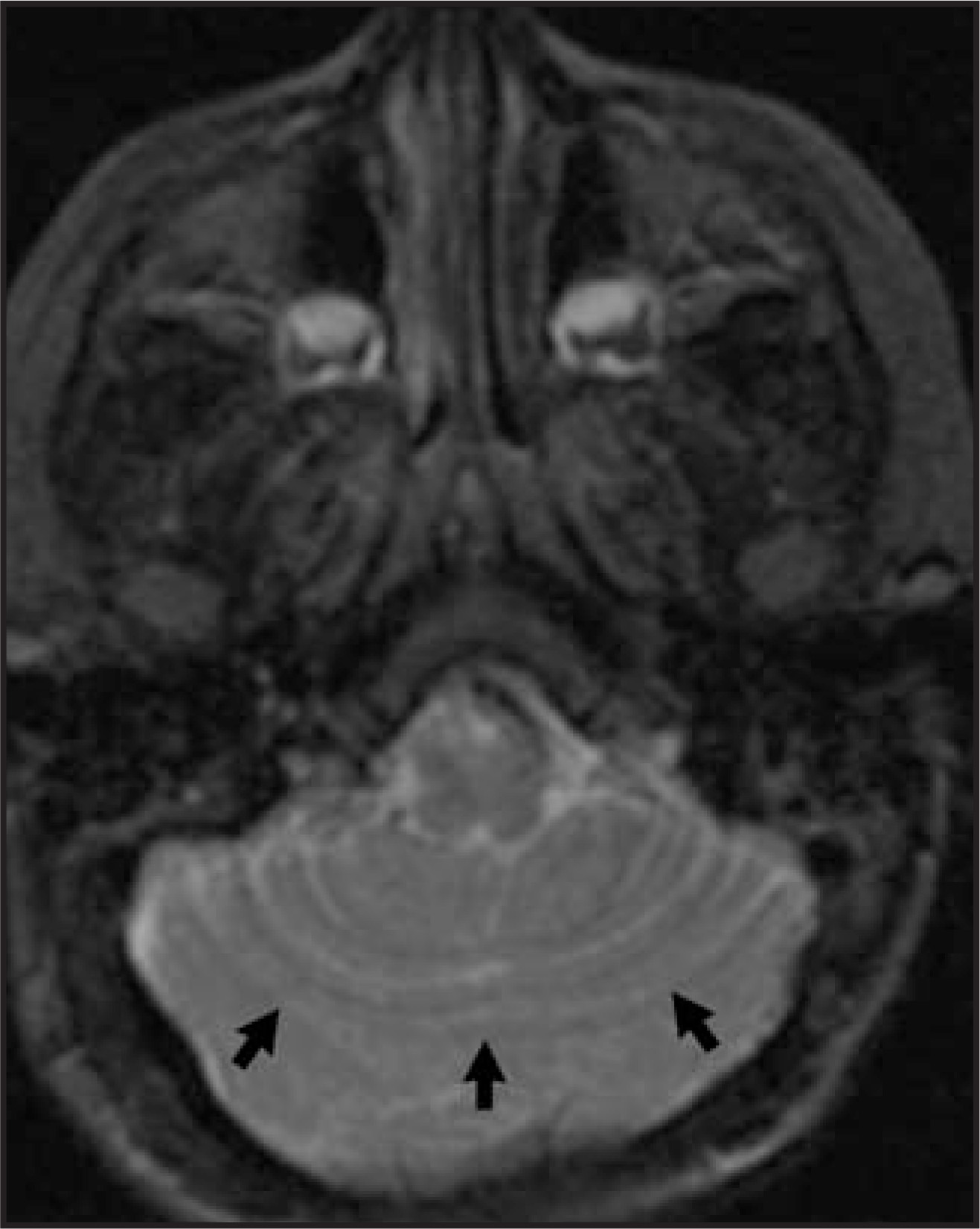 FIGURE 18.