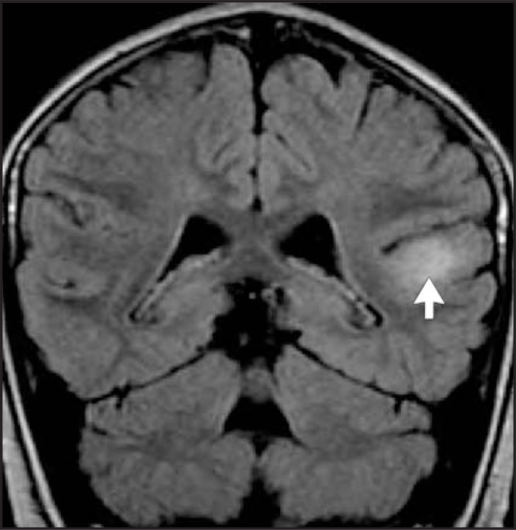 FIGURE 20.