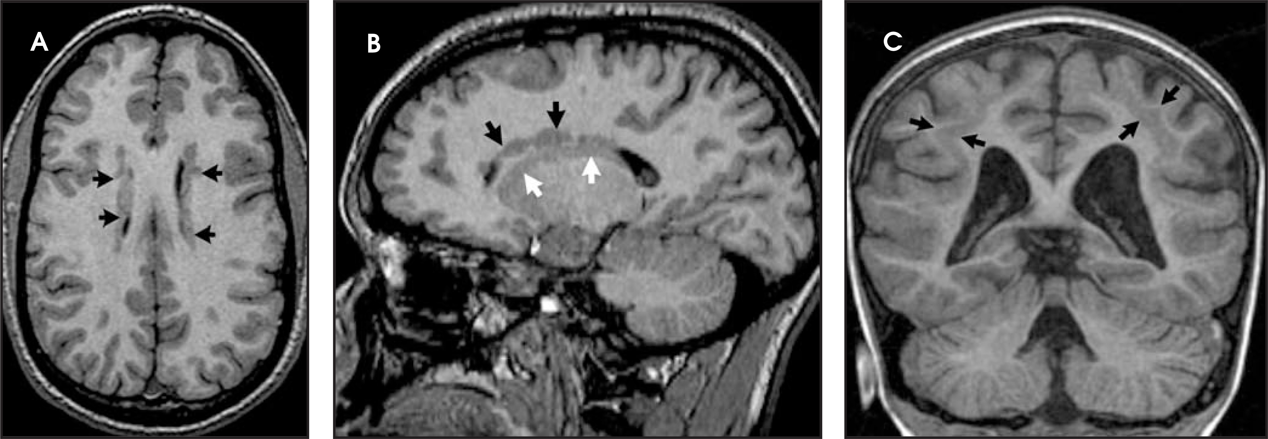 FIGURE 21.