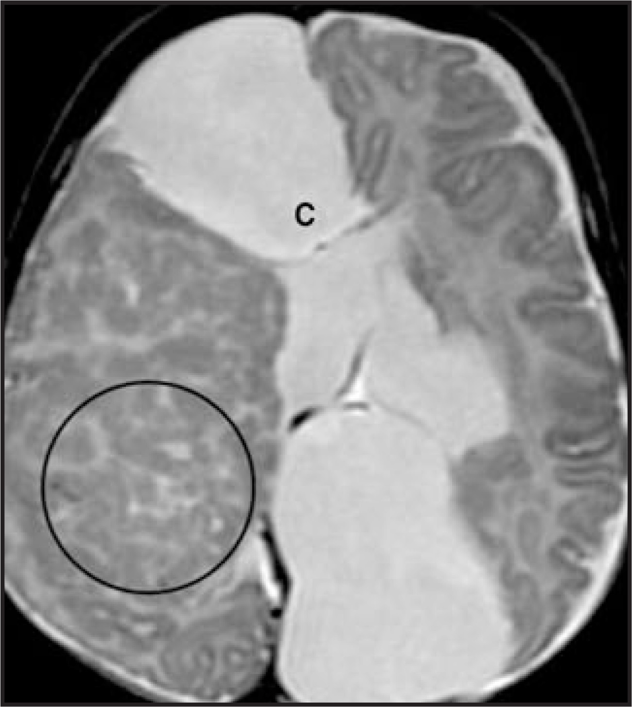 FIGURE 22.