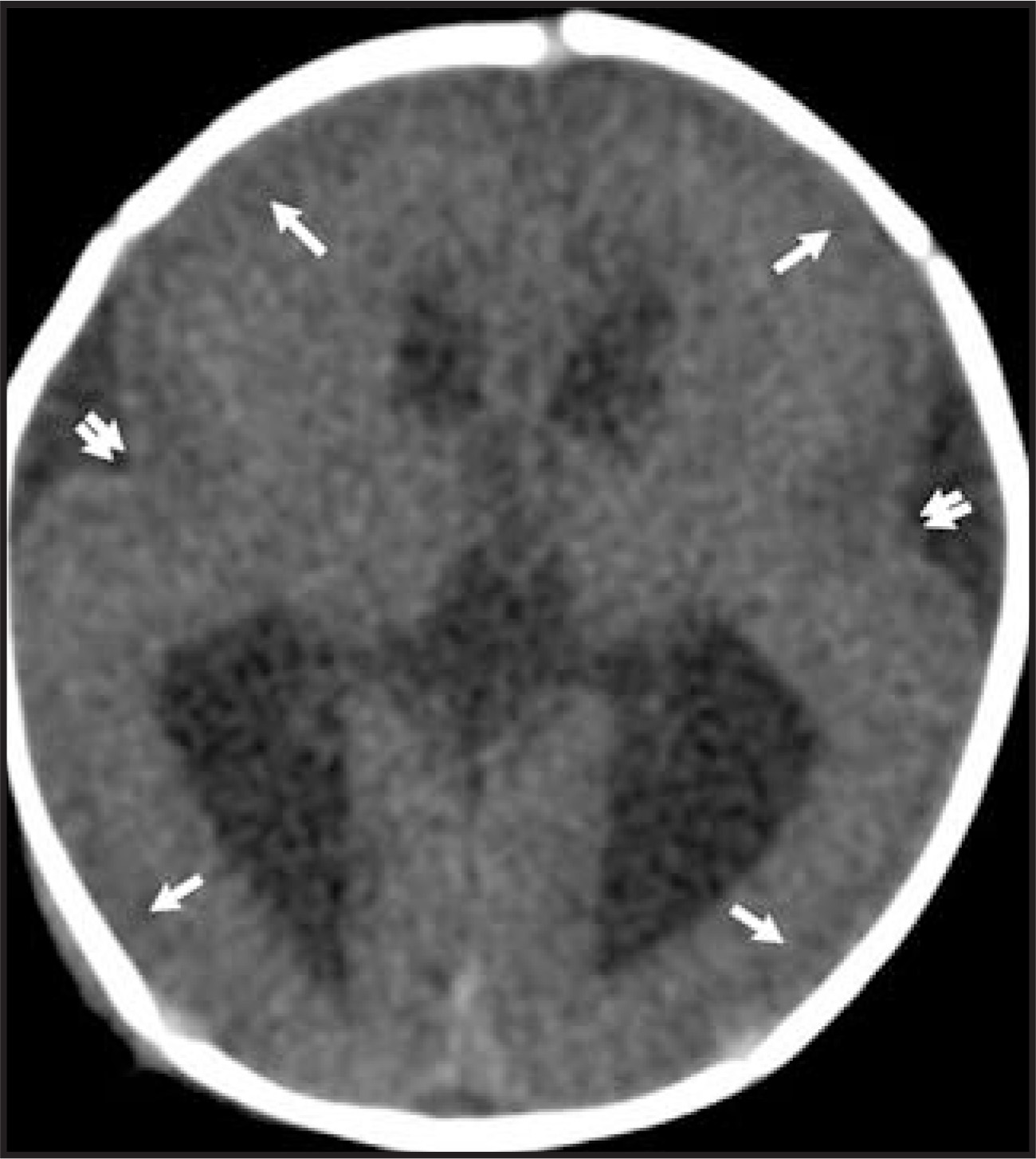 FIGURE 23.
