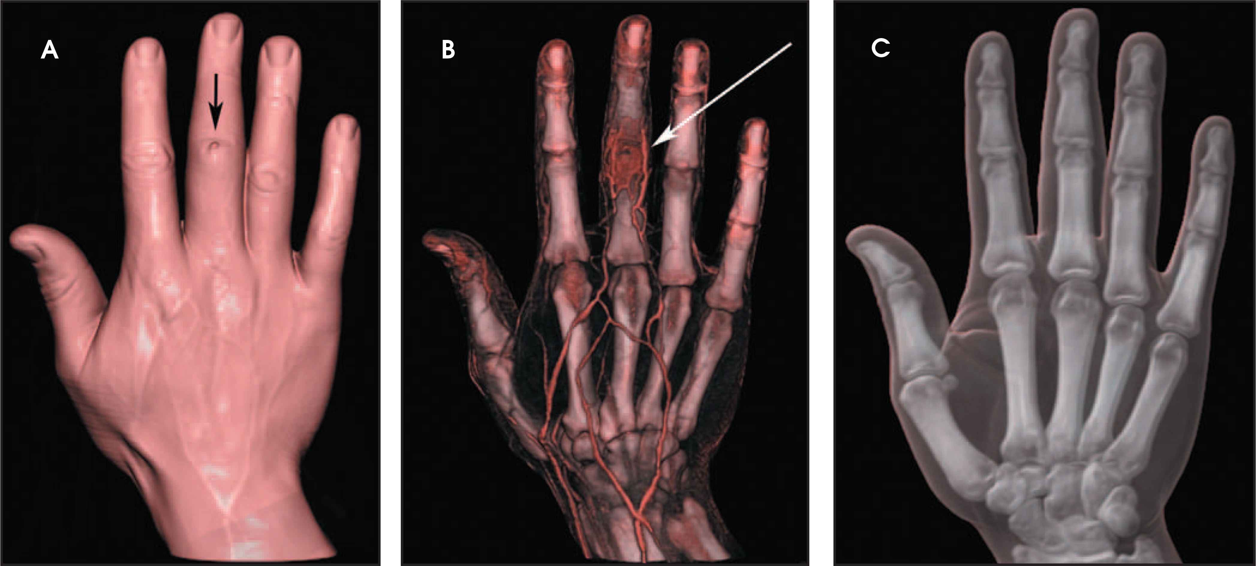FIGURE 6.