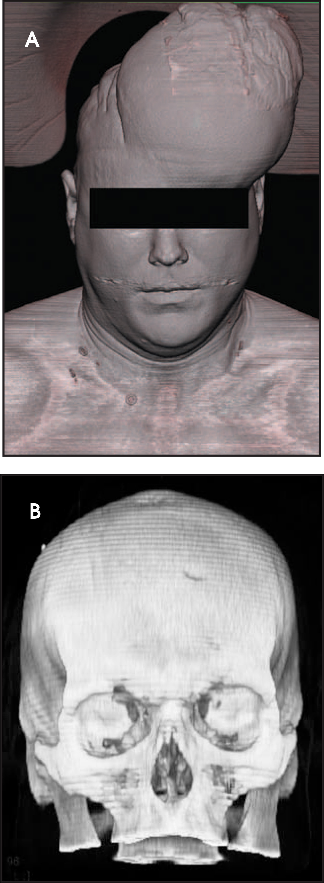 FIGURE 11.