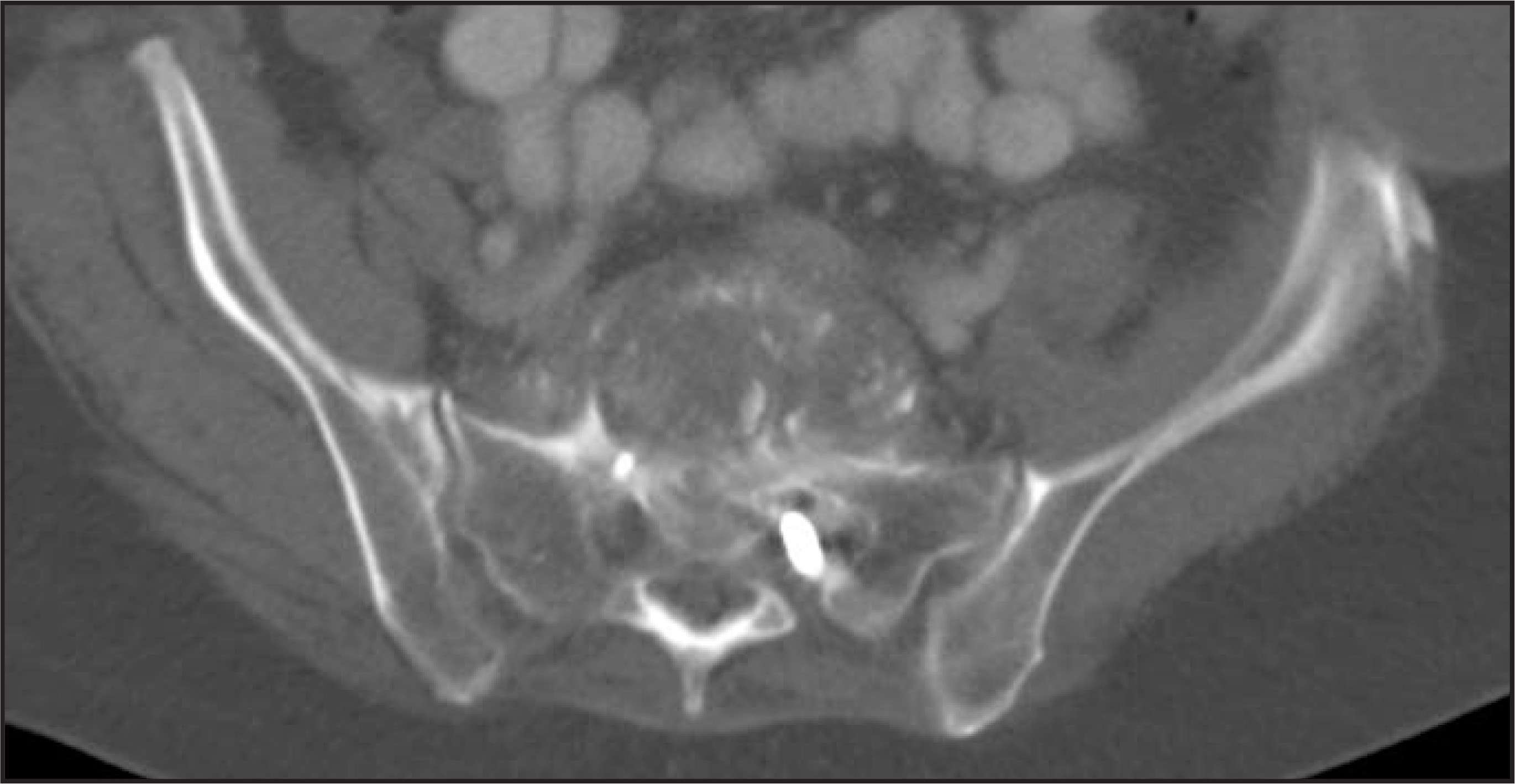 FIGURE 13.