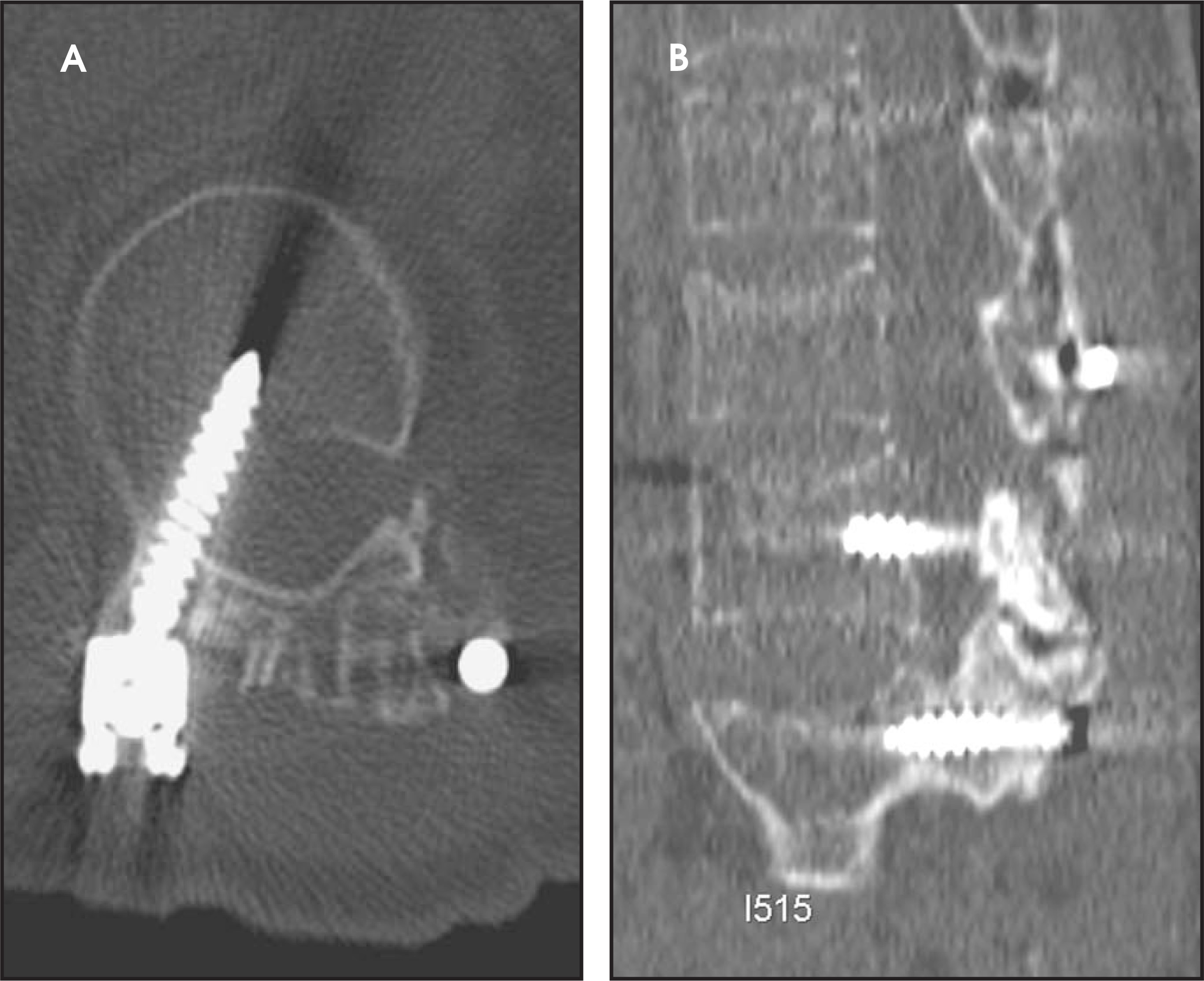 FIGURE 14.