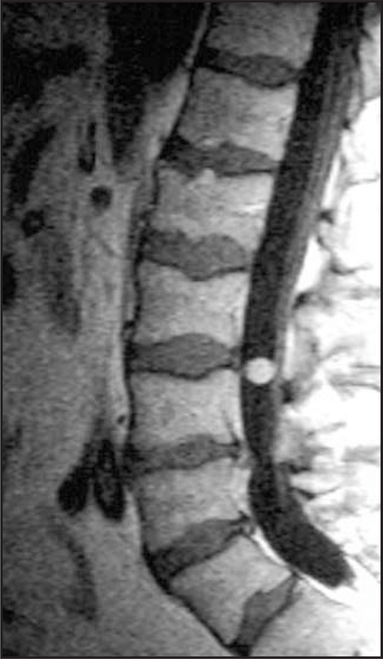 FIGURE 11.