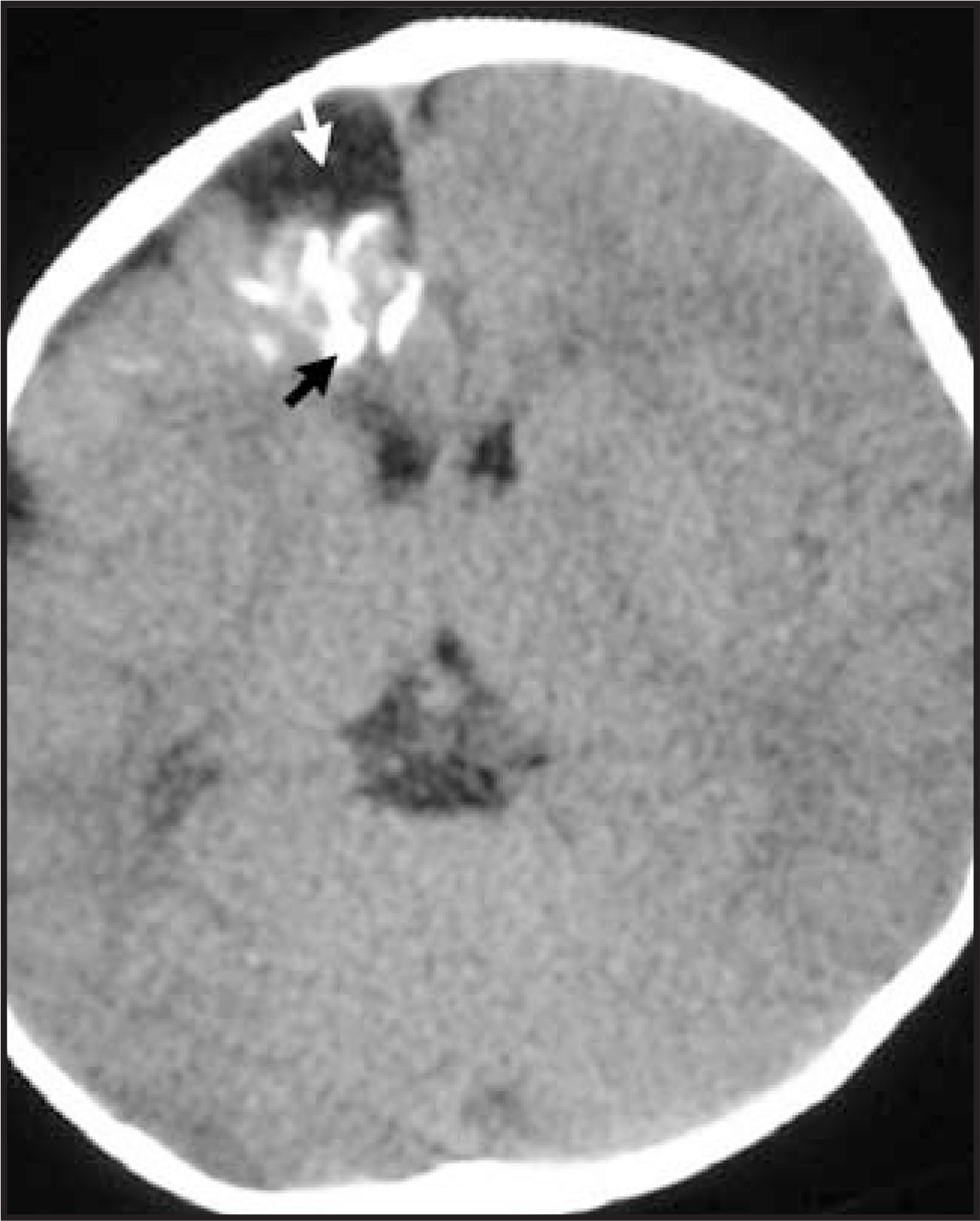 FIGURE 3: