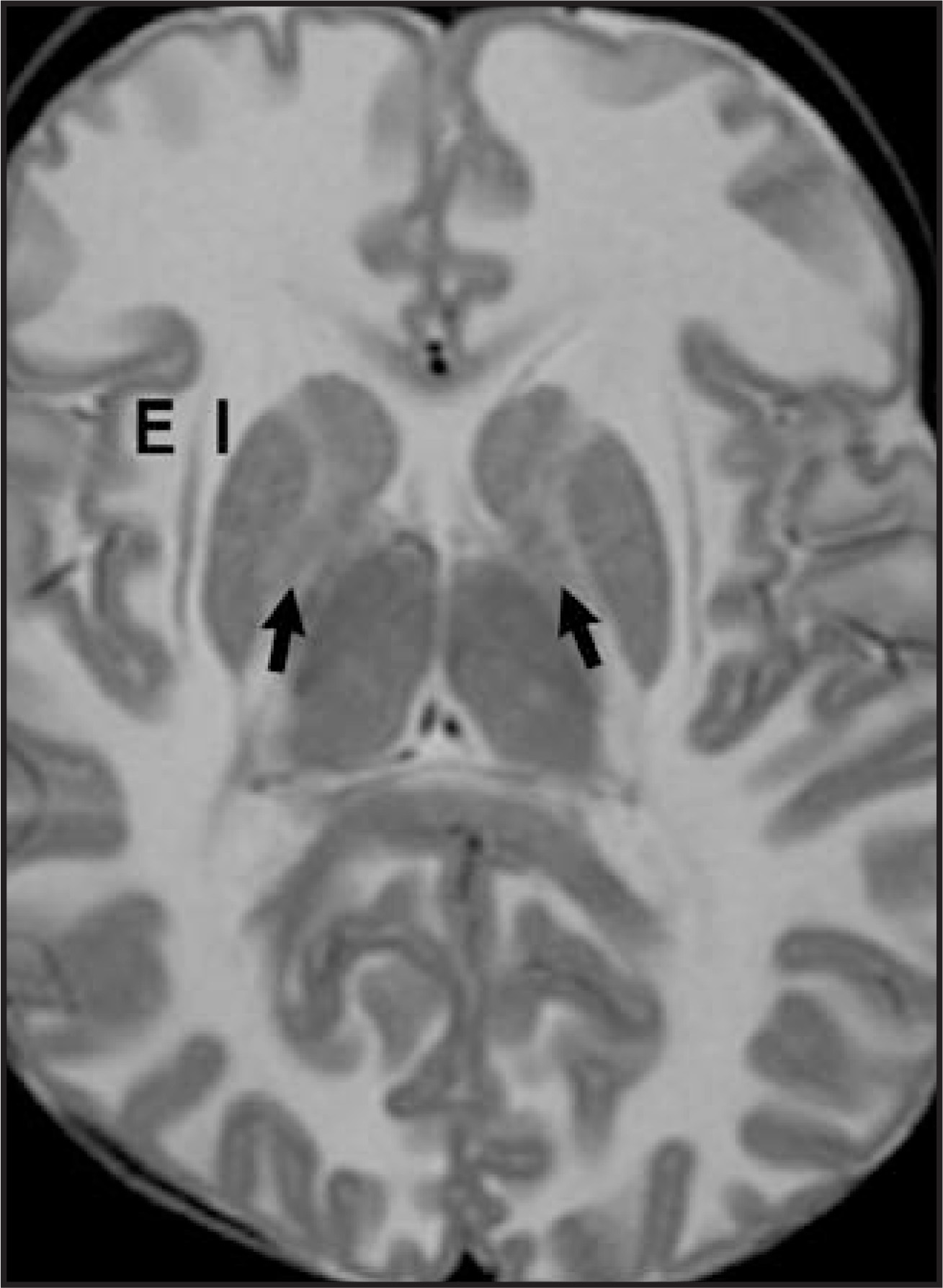 FIGURE 11.