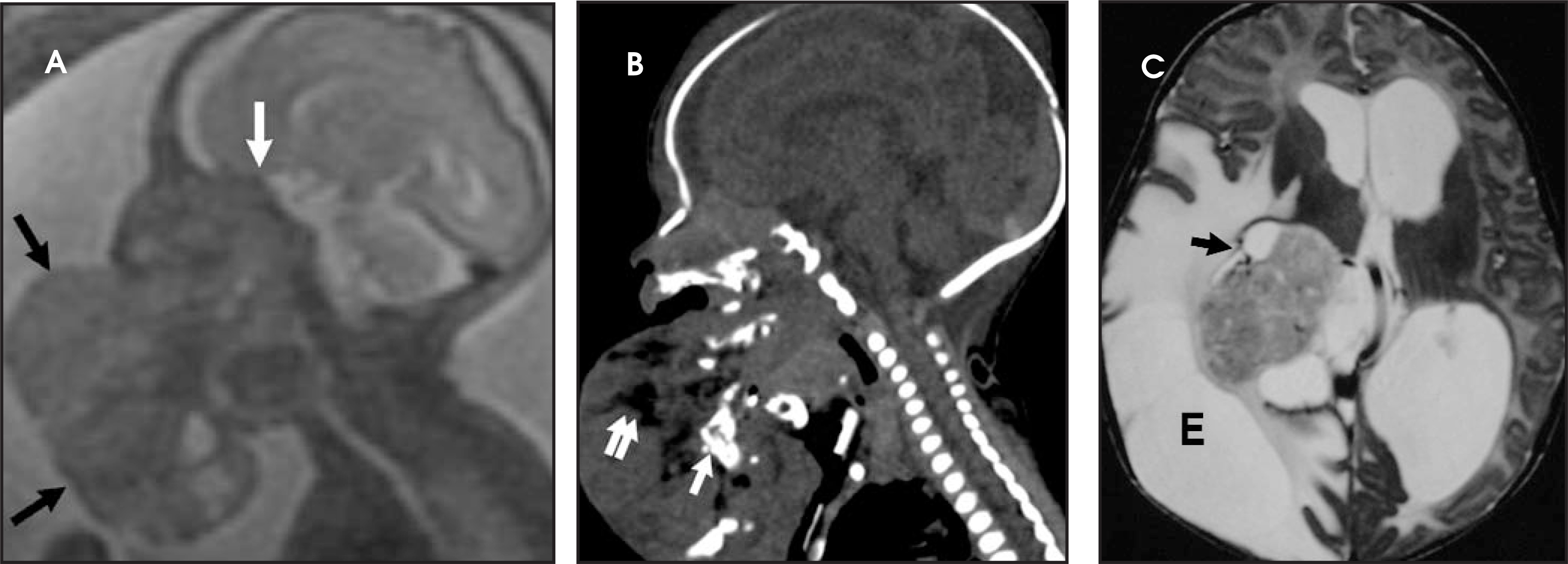 FIGURE 12.