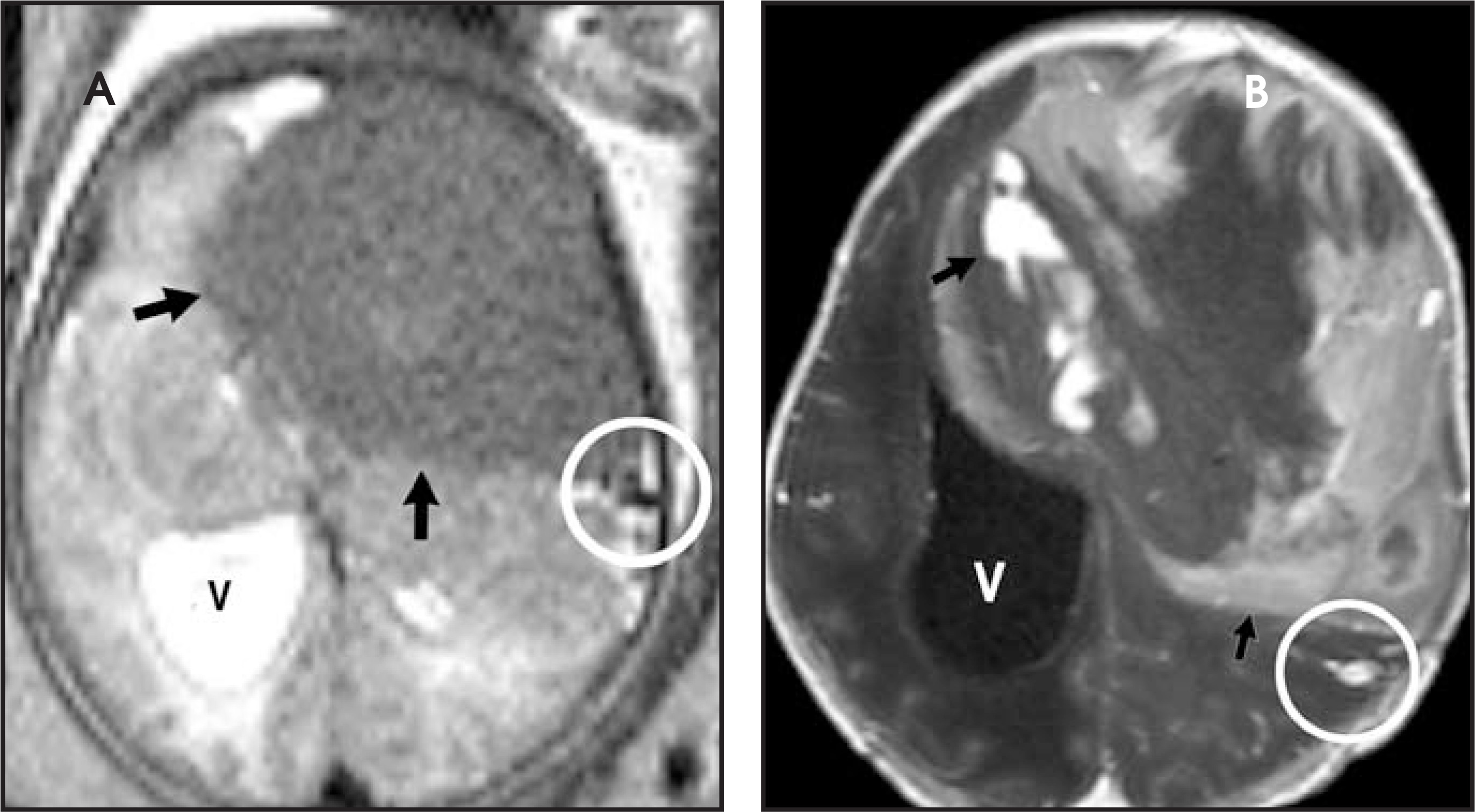 FIGURE 13.