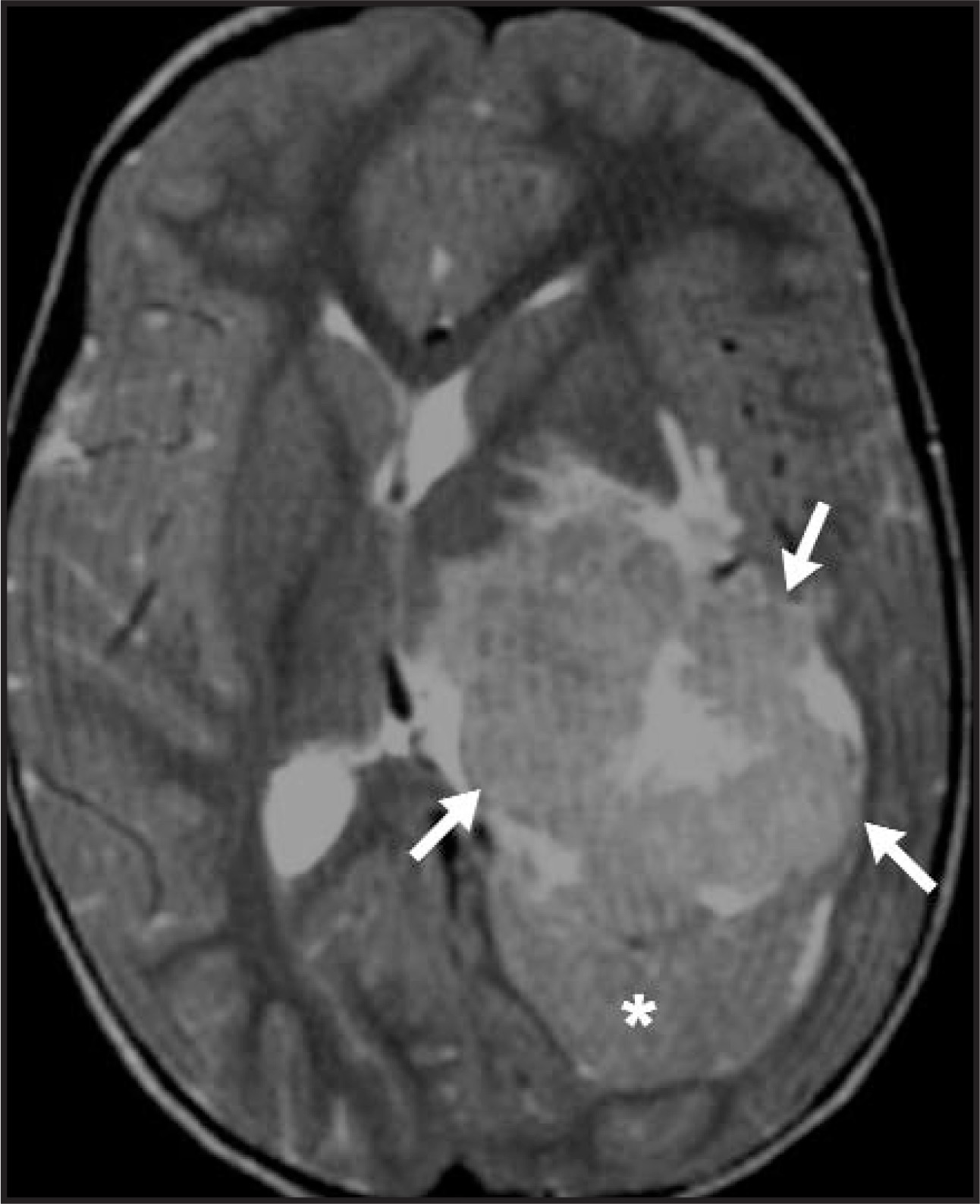 FIGURE 14.